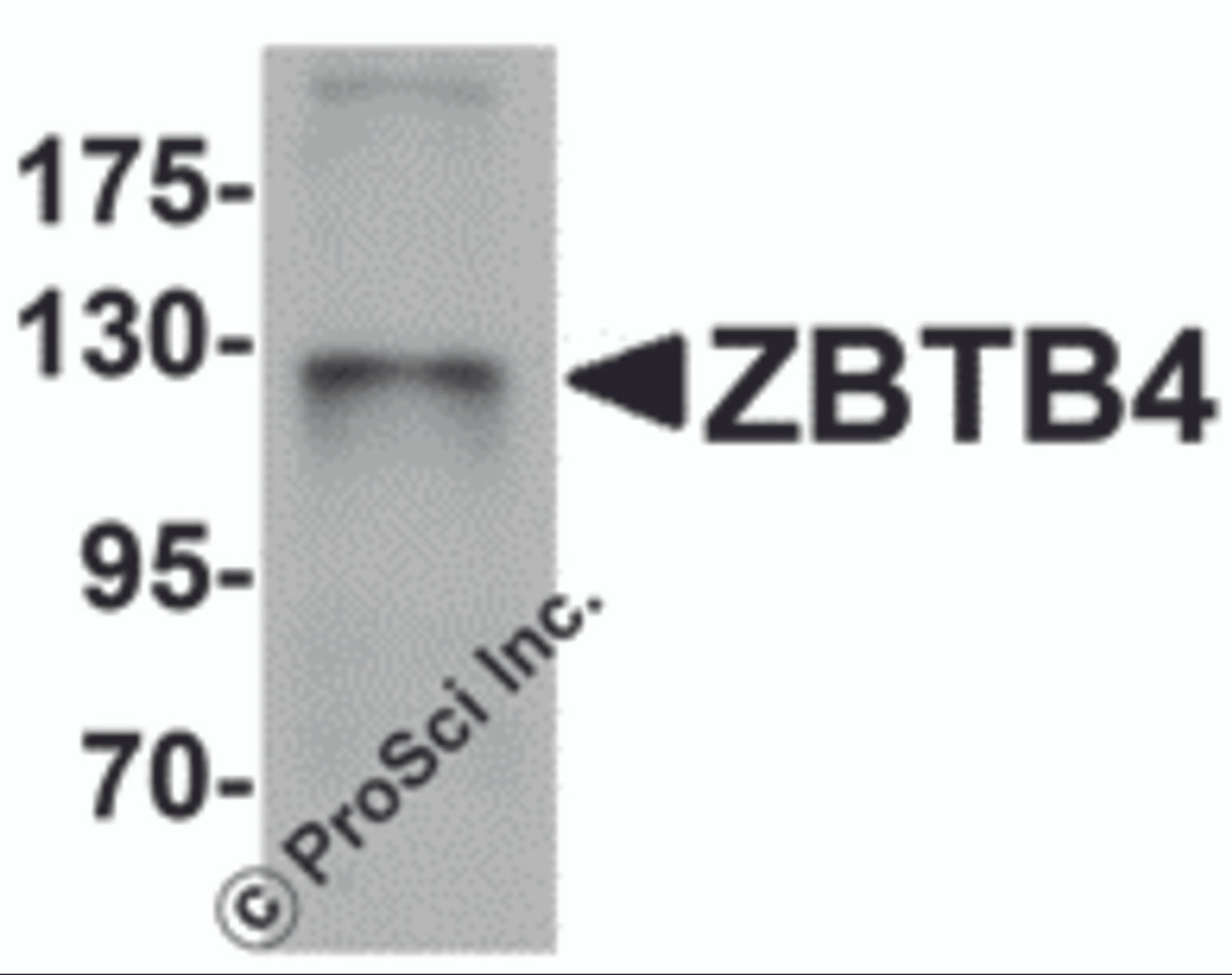 Western blot analysis of ZBTB4 in SK-N-SH cell lysate with ZBTB4 antibody at 1 &#956;g/mL.
