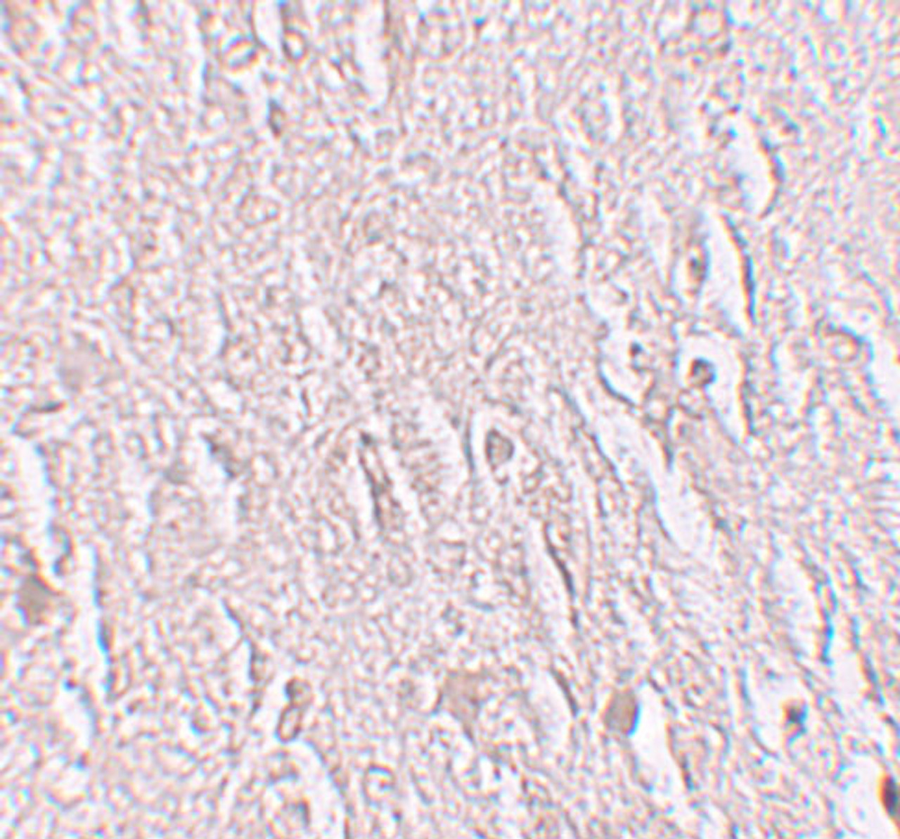 Immunohistochemistry of ZBTB5 in human brain tissue with ZBTB5 antibody at 2.5 ug/mL.