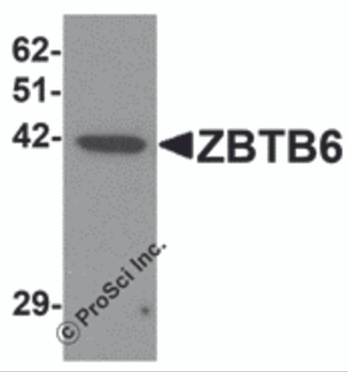 Western blot analysis of ZBTB6 in EL4 cell lysate with ZBTB6 antibody at 1 &#956;g/mL.