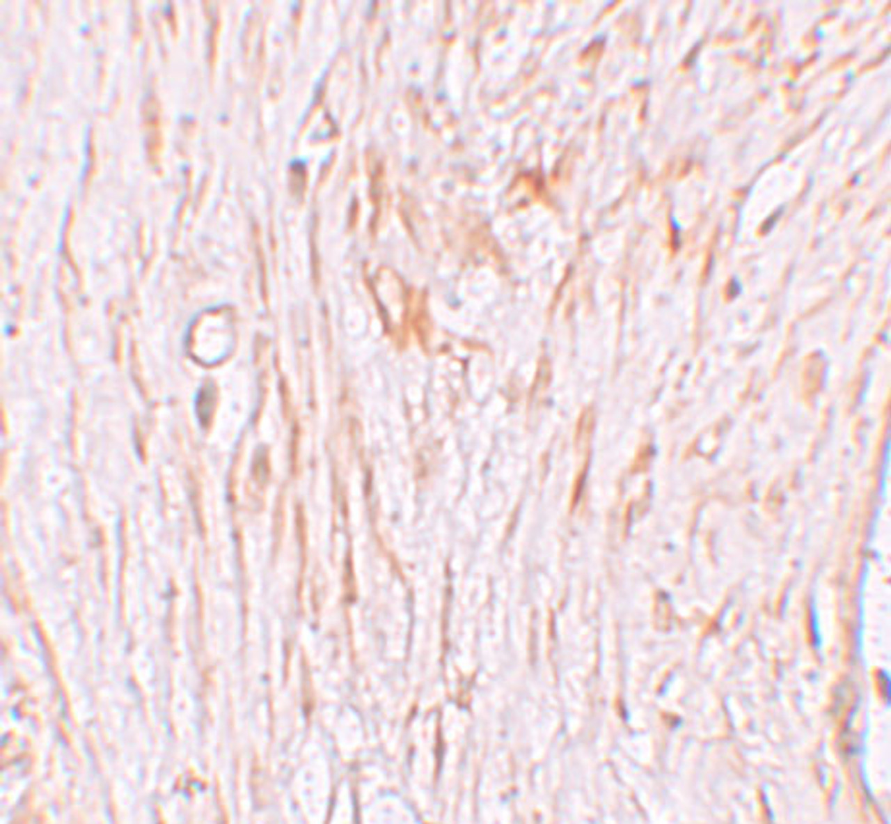 Immunohistochemistry of ZBTB7A in human ovary tissue with ZBTB7A antibody at 2.5 ug/mL.