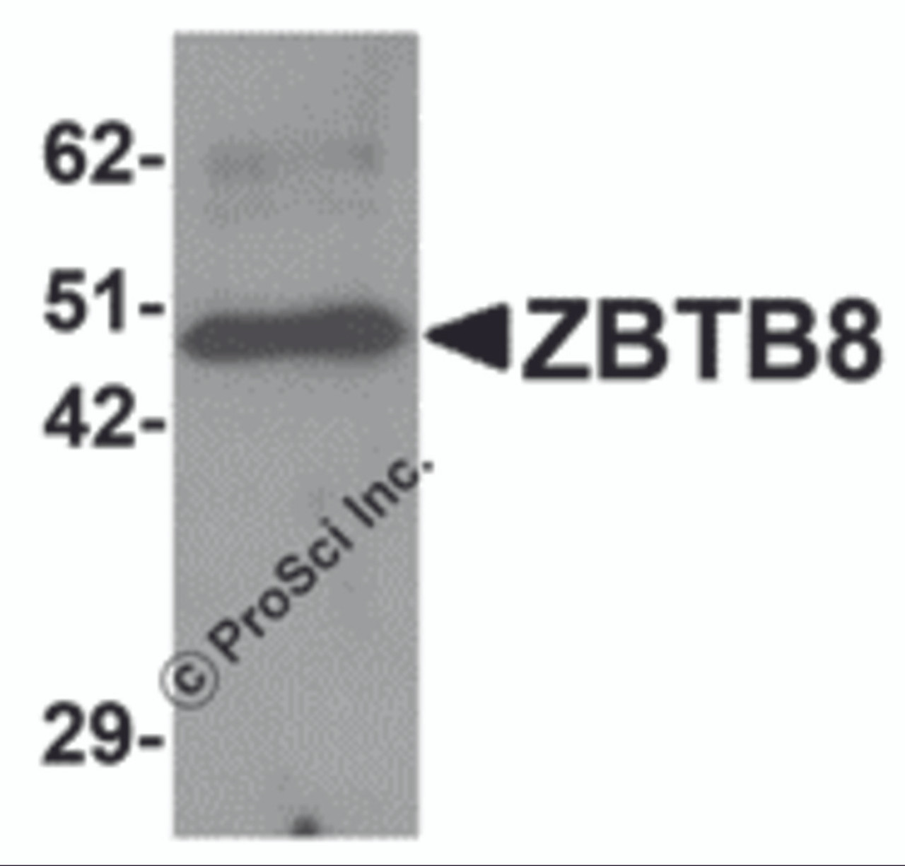 Western blot analysis of ZBTB8 in mouse spleen tissue lysate with ZBTB8 antibody at 1 &#956;g/mL.