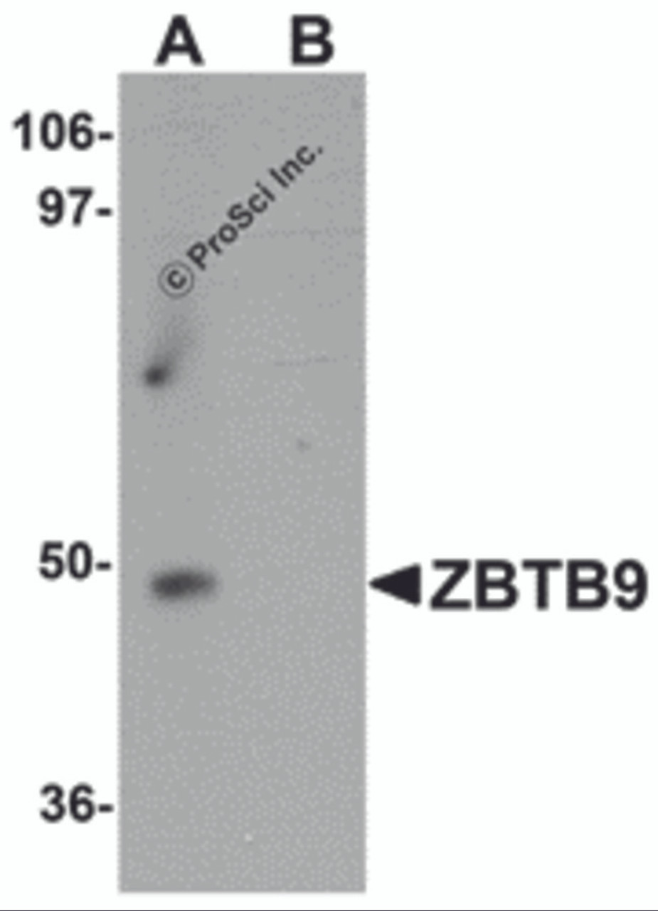 Western blot analysis of ZBTB9 in mouse heart tissue lysate with ZBTB9 antibody at 1 &#956;g/mL in (A) the absence and (B) the presence of blocking peptide.