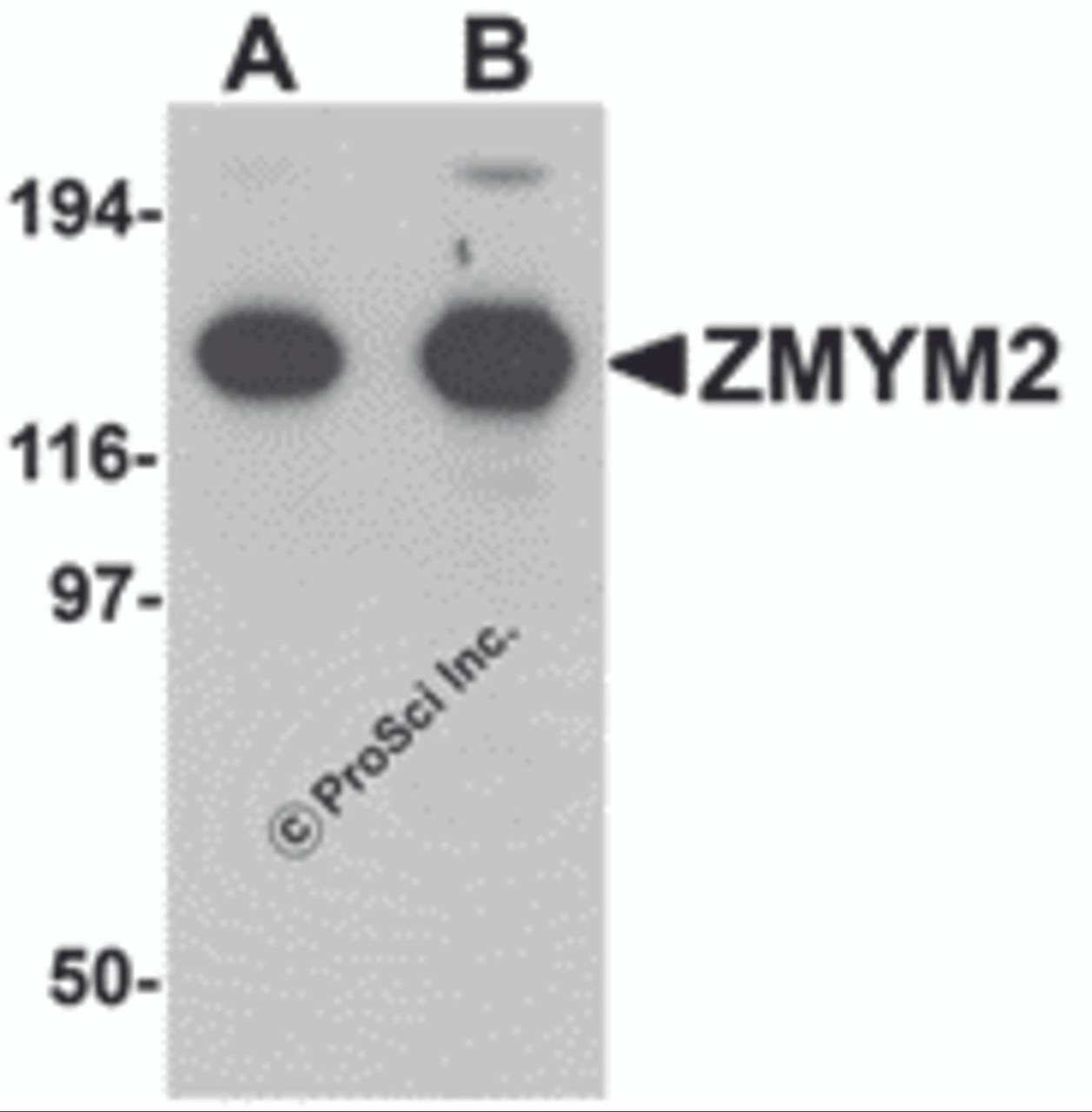 Western blot analysis of ZMYM2 in EL4 cell lysate with ZMYM2 antibody at (A) 0.125 and (B) 0.25 &#956;g/mL.