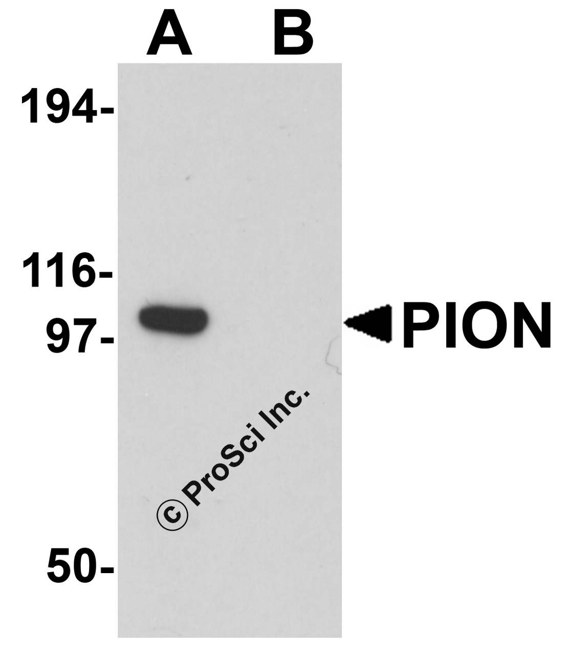 Western blot analysis of PION in EL4 cell lysate with PION antibody at 0.25 &#956;g/mL in (A) the absence and (B) the presence of blocking peptide.