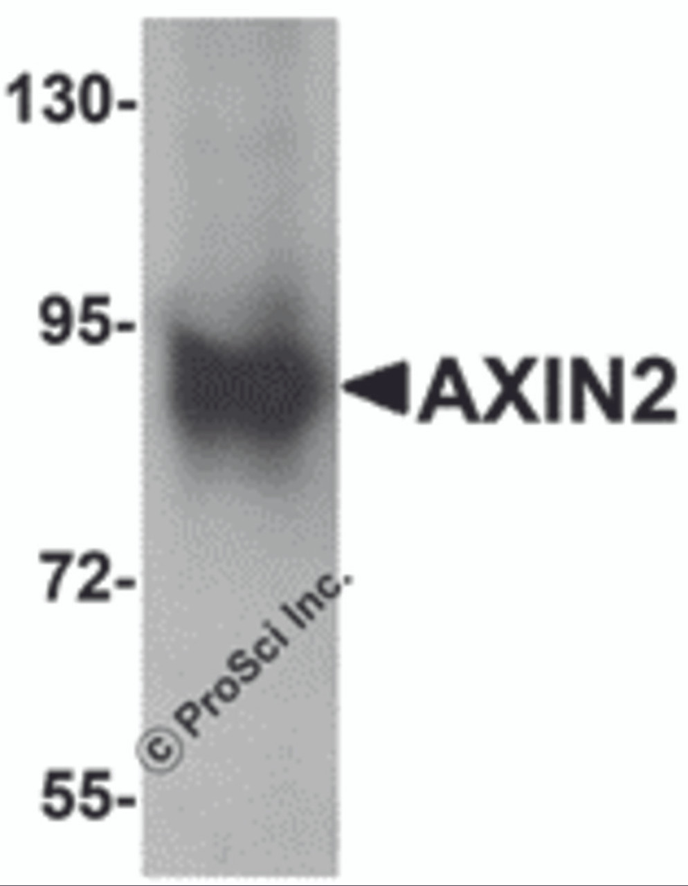 Western blot analysis of AXIN2 in mouse lung lysate with AXIN2 antibody at 1 &#956;g/mL.