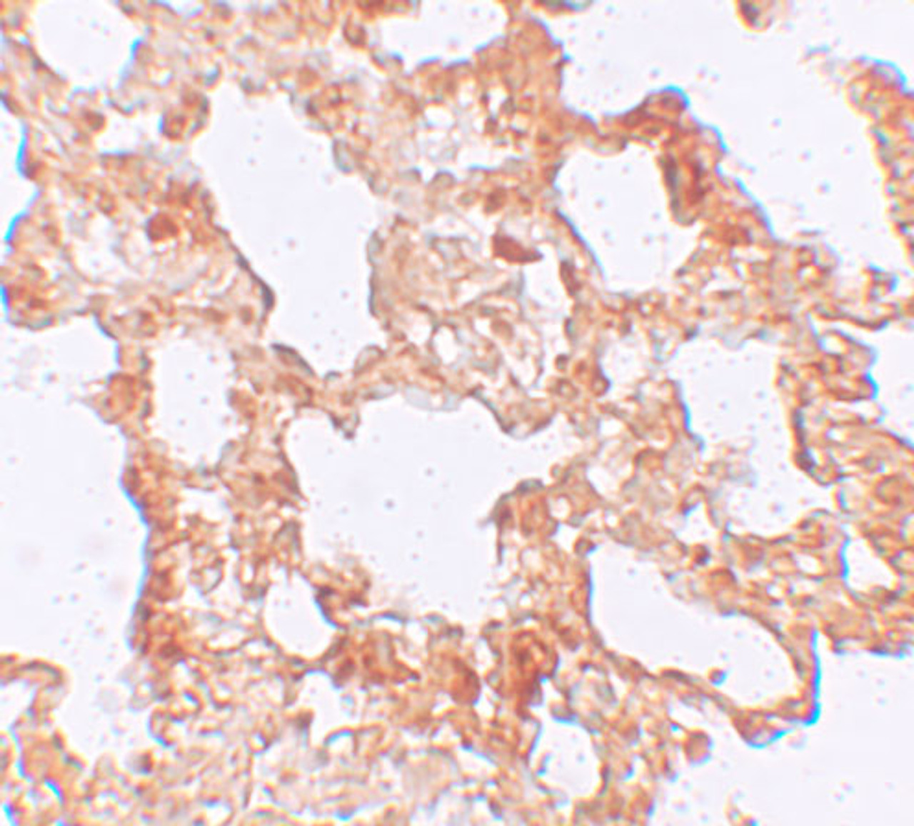 Immunohistochemistry of AXIN2 in rat lung tissue with AXIN2 antibody at 5 ug/mL.