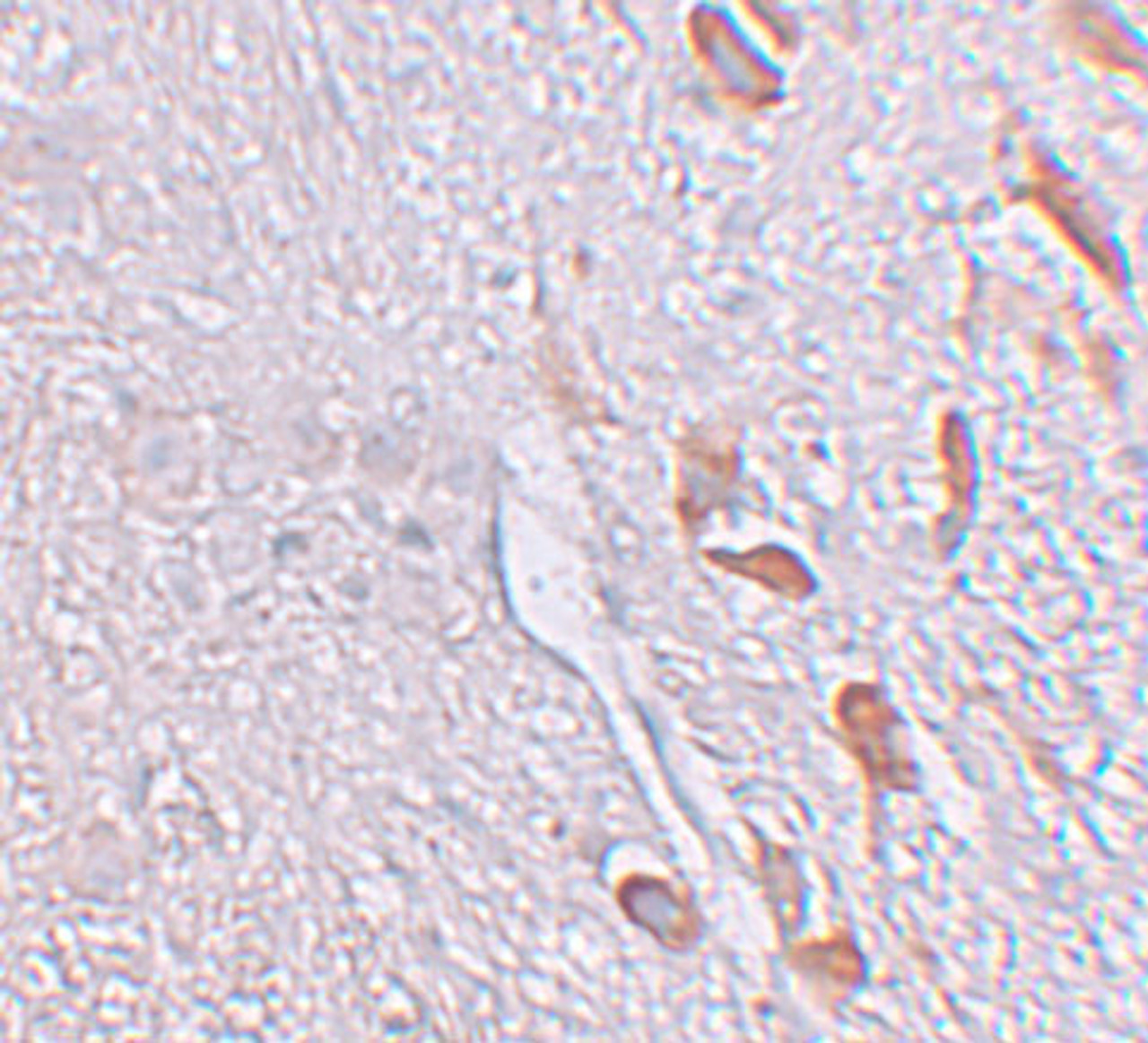 Immunohistochemistry of LRRTM1 in human brain tissue with LRRTM1 antibody at 5 ug/mL.