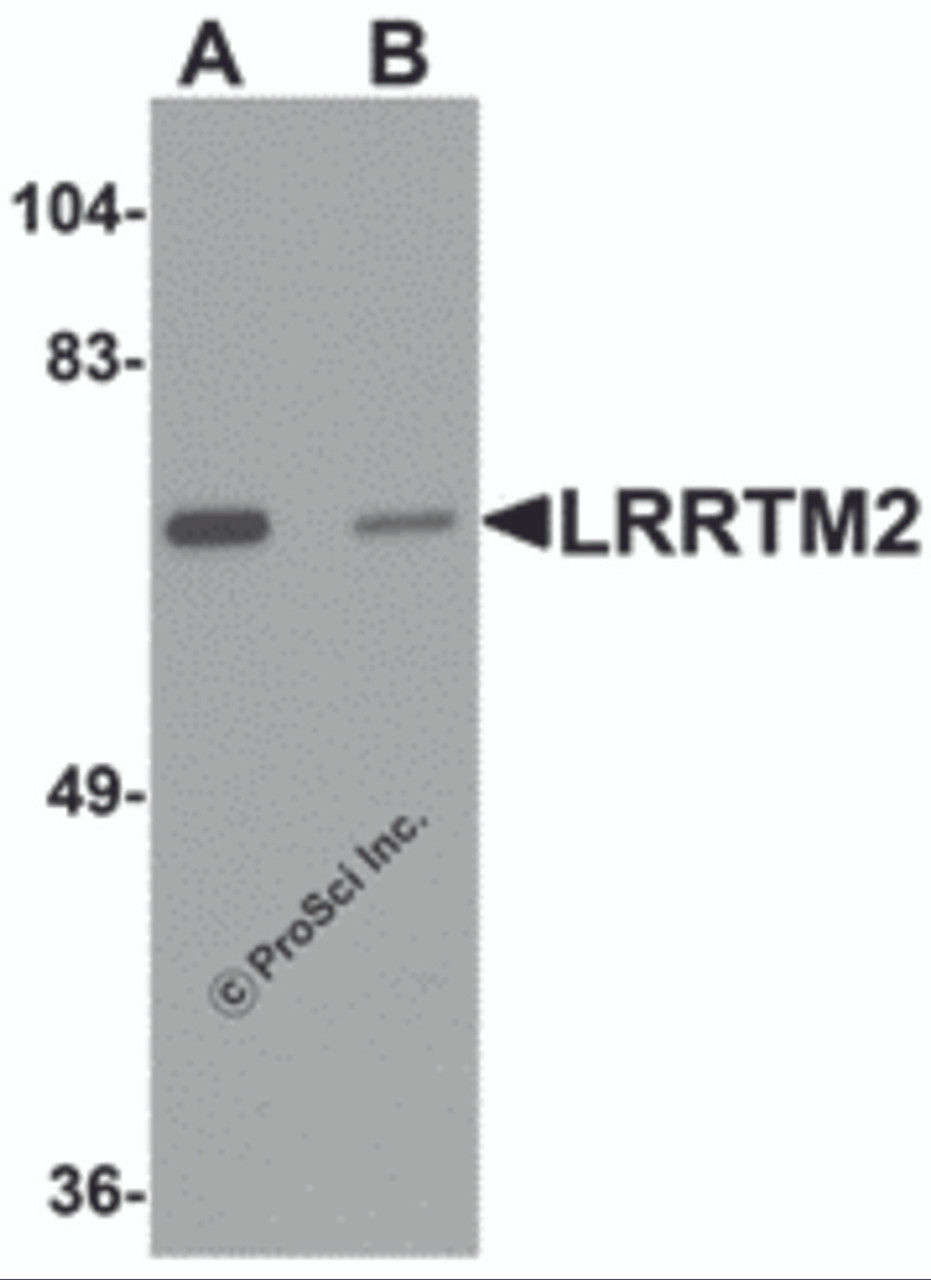 Western blot analysis of LRRTM2 in SK-N-SH cell lysate with LRRTM2 antibody at 1 &#956;g/mL in (A) the absence and (B) the presence of blocking peptide.