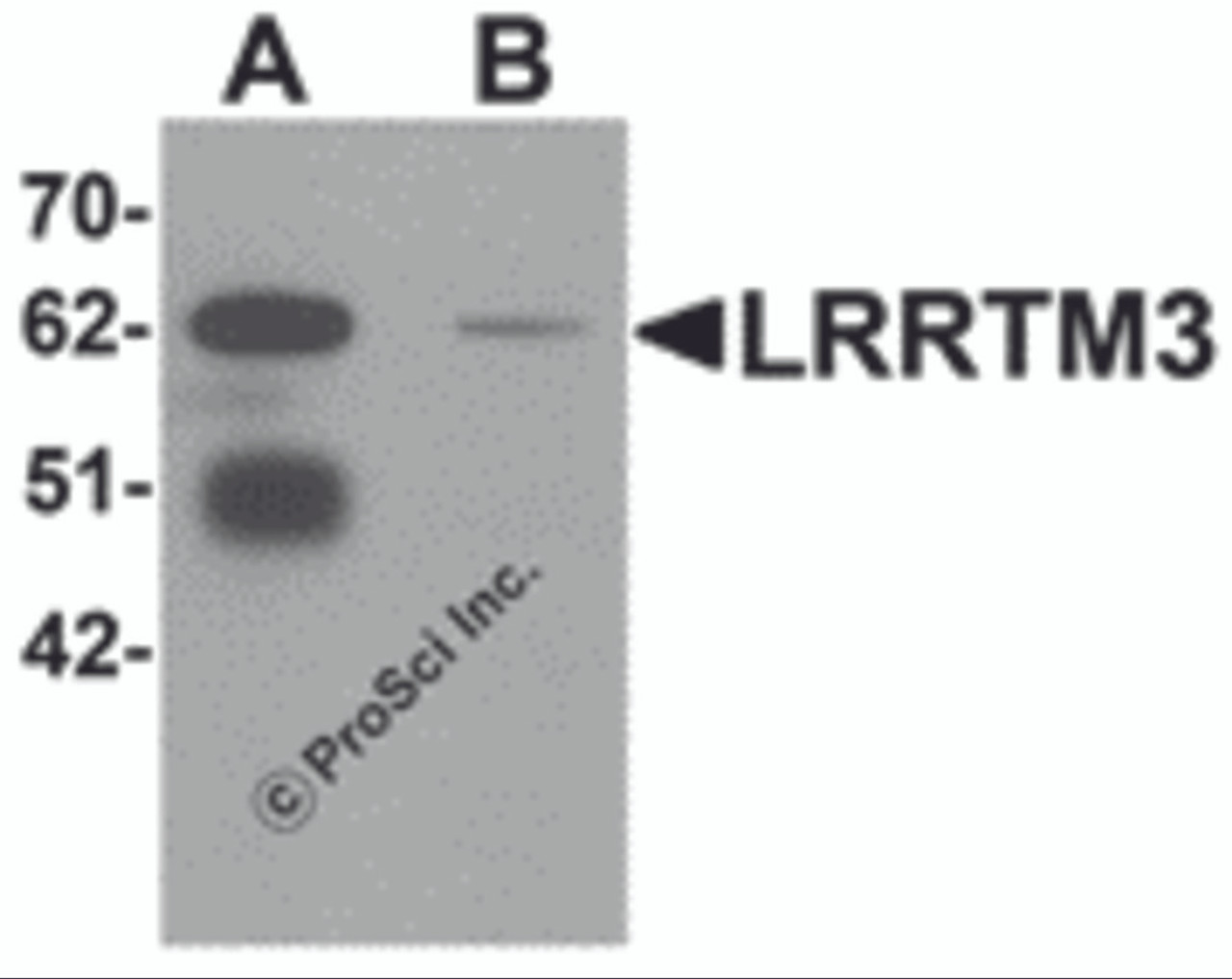 Western blot analysis of LRRTM3 in mouse brain tissue lysate with LRRTM3 antibody at 0.5 &#956;g/mL in (A) the absence and (B) the presence of blocking peptide.