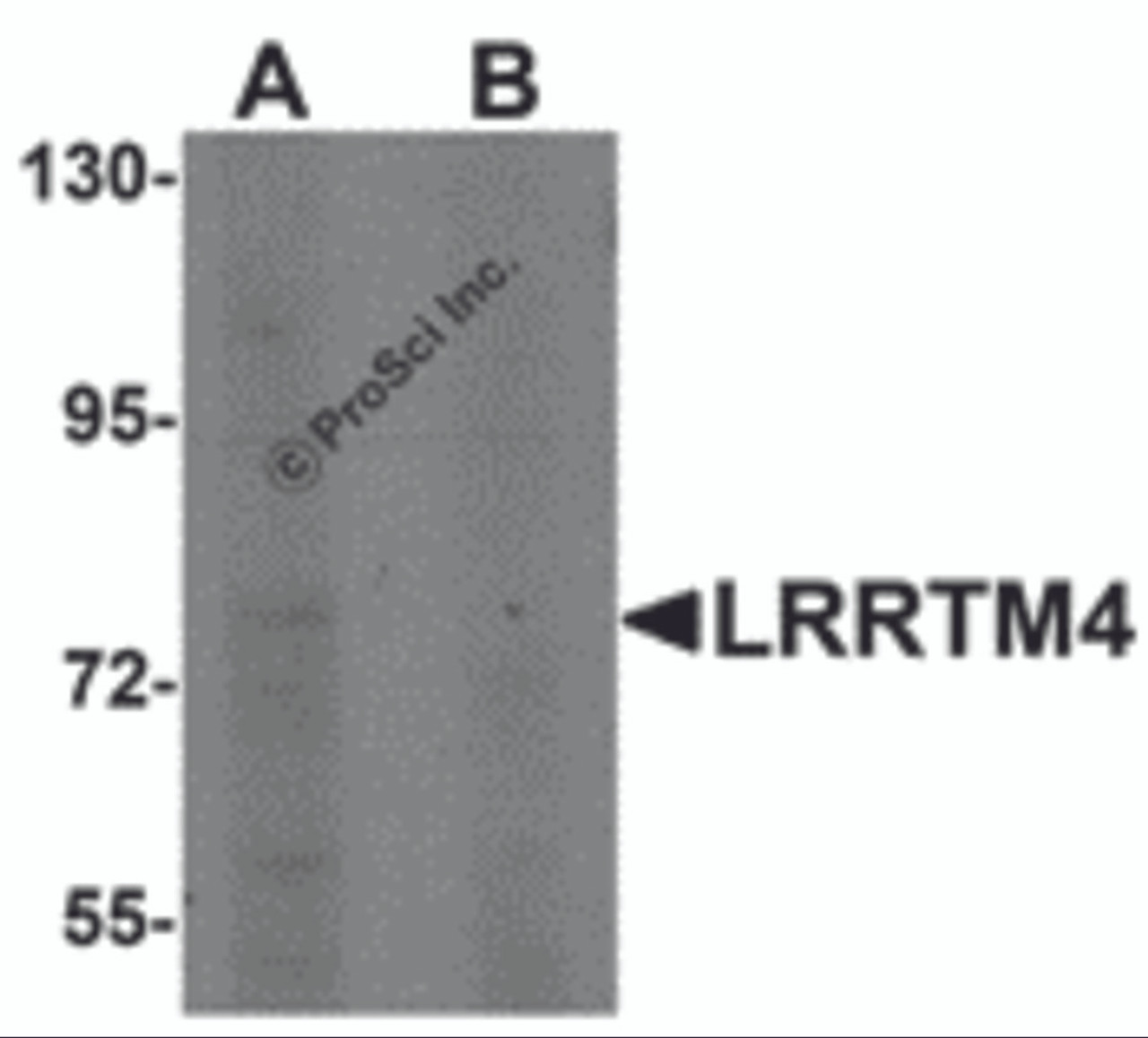 Western blot analysis of LRRTM4 in HeLa cell lysate with LRRTM4 antibody at 1 &#956;g/mL in (A) the absence and (B) the presence of blocking peptide.
