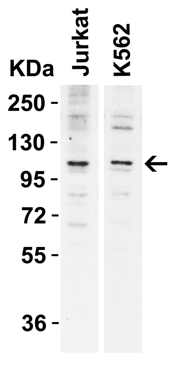 WB Validation in Human Cell Lines
Loading: 15 &#956;g of lysates 
Antibodies: N4BP1, 6175 1 &#956;g/ml, 1 h incubation at RT in 5% NFDM/TBST.
Secondary: Goat Anti-Rabbit IgG HRP conjugate at 1:10000 dilution.
Exposure: 30 sec