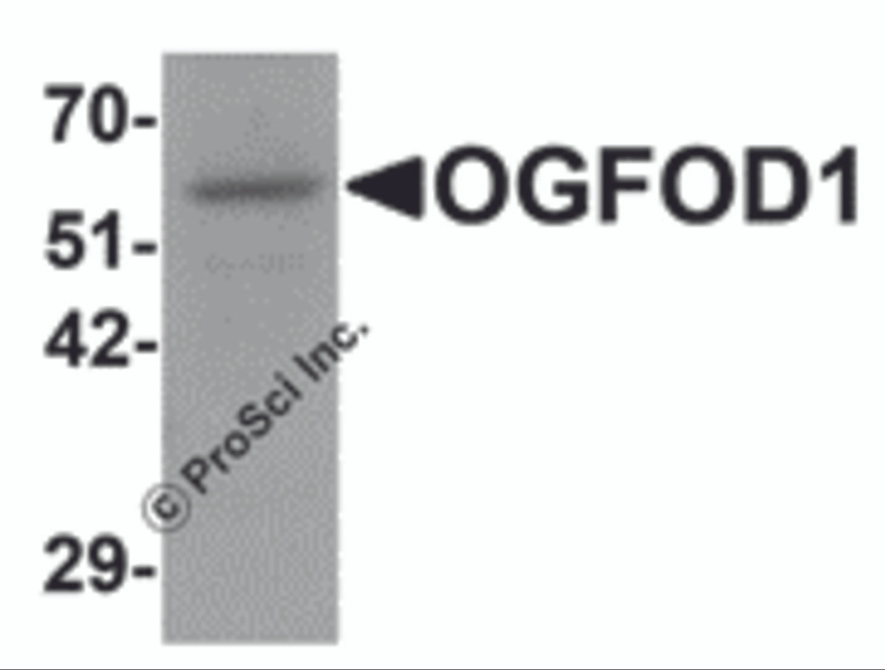 Western blot analysis of OGFOD1 in Daudi cell lysate with OGFOD1 antibody at 1 &#956;g/mL.