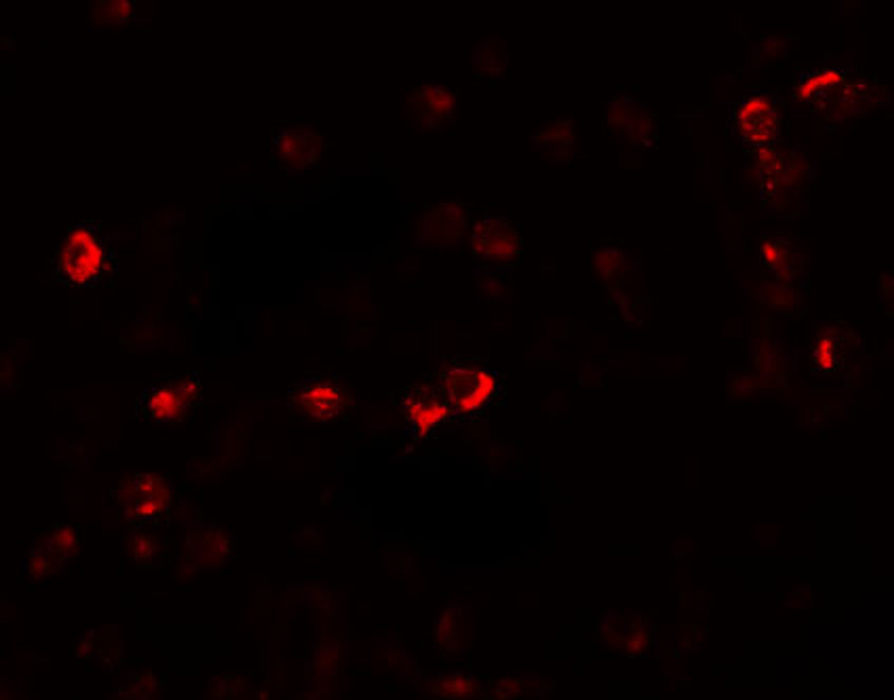 Immunofluorescence of OGFOD1 in Daudi cells with OGFOD1 antibody at 20 ug/mL.