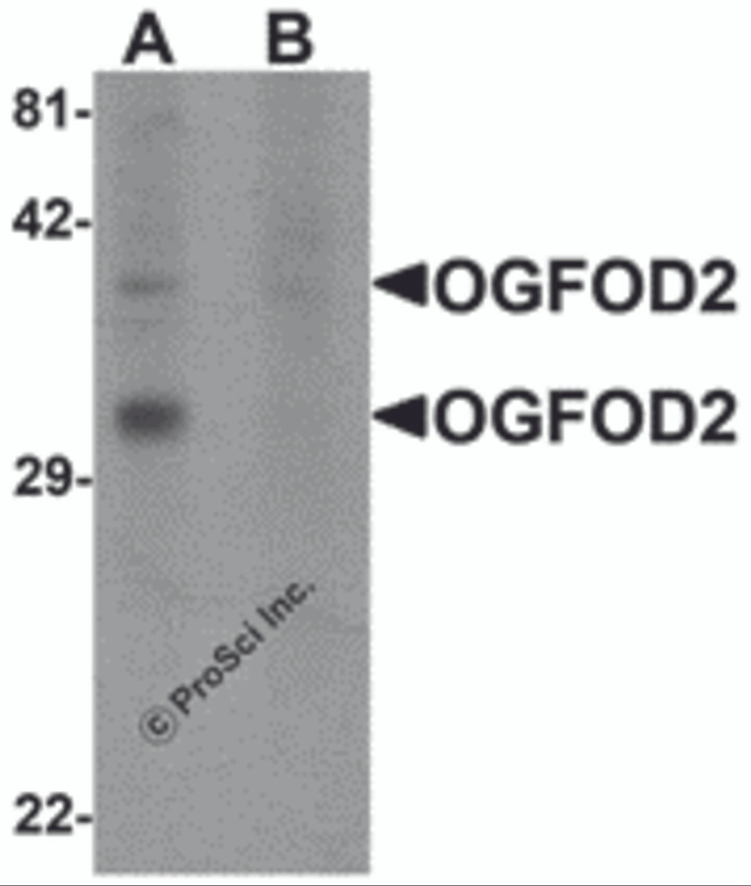 Western blot analysis of OGFOD2 in 293 cell lysate with OGFOD2 antibody at 1 &#956;g/mL in (A) the absence and (B) the presence of blocking peptide.