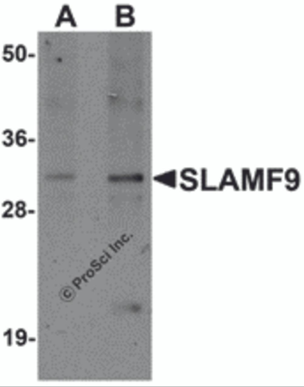 Western blot analysis of SLAMF9 in mouse kidney tissue lysate with SLAMF9 antibody at (A) 1 and (B) 2 &#956;g/mL.