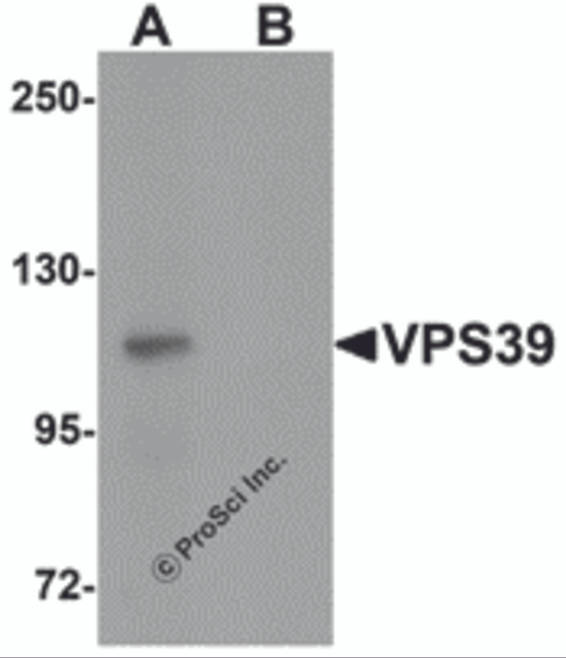 Western blot analysis of VPS39 in rat liver tissue lysate with VPS39 antibody at 0.5 &#956;g/mL in (A) the absence and (B) the presence of blocking peptide.