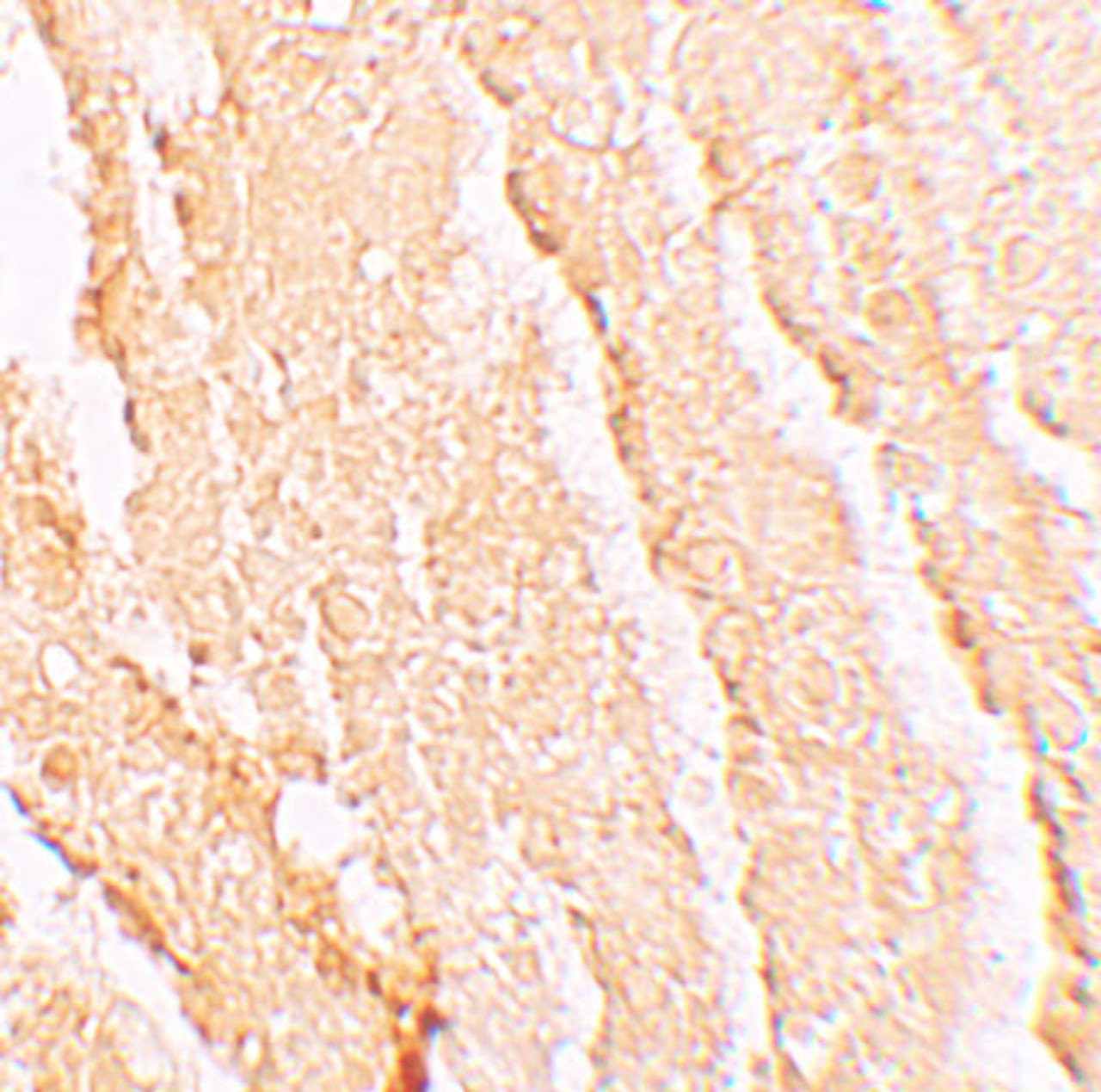 Immunohistochemistry of VPS39 in mouse liver tissue with VPS39 antibody at 5 ug/mL.