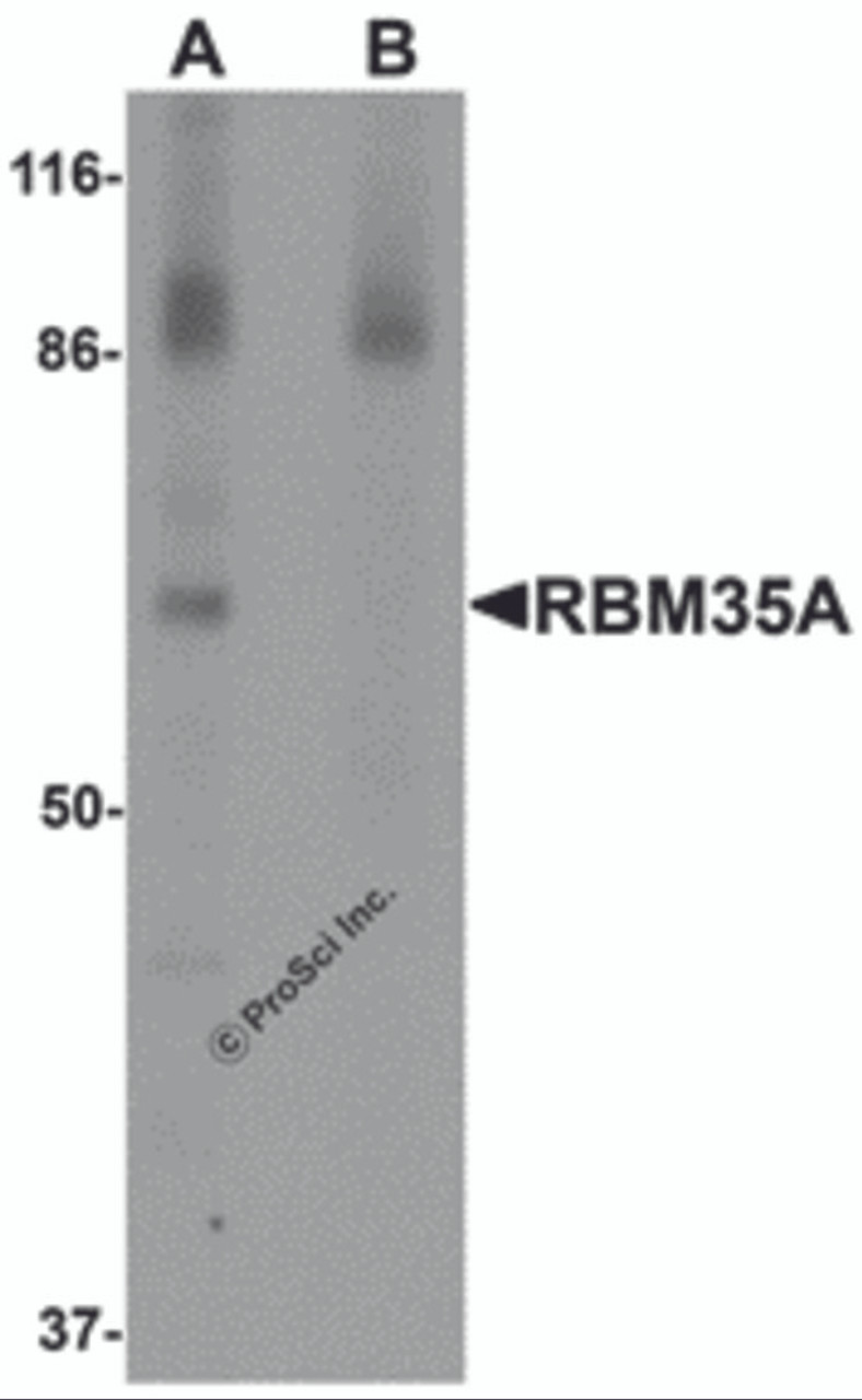 Western blot analysis of RBM35A in rat colon tissue lysate with RBM35A antibody at 0.5 &#956;g/mL in (A) the absence and (B) the presence of blocking peptide.
