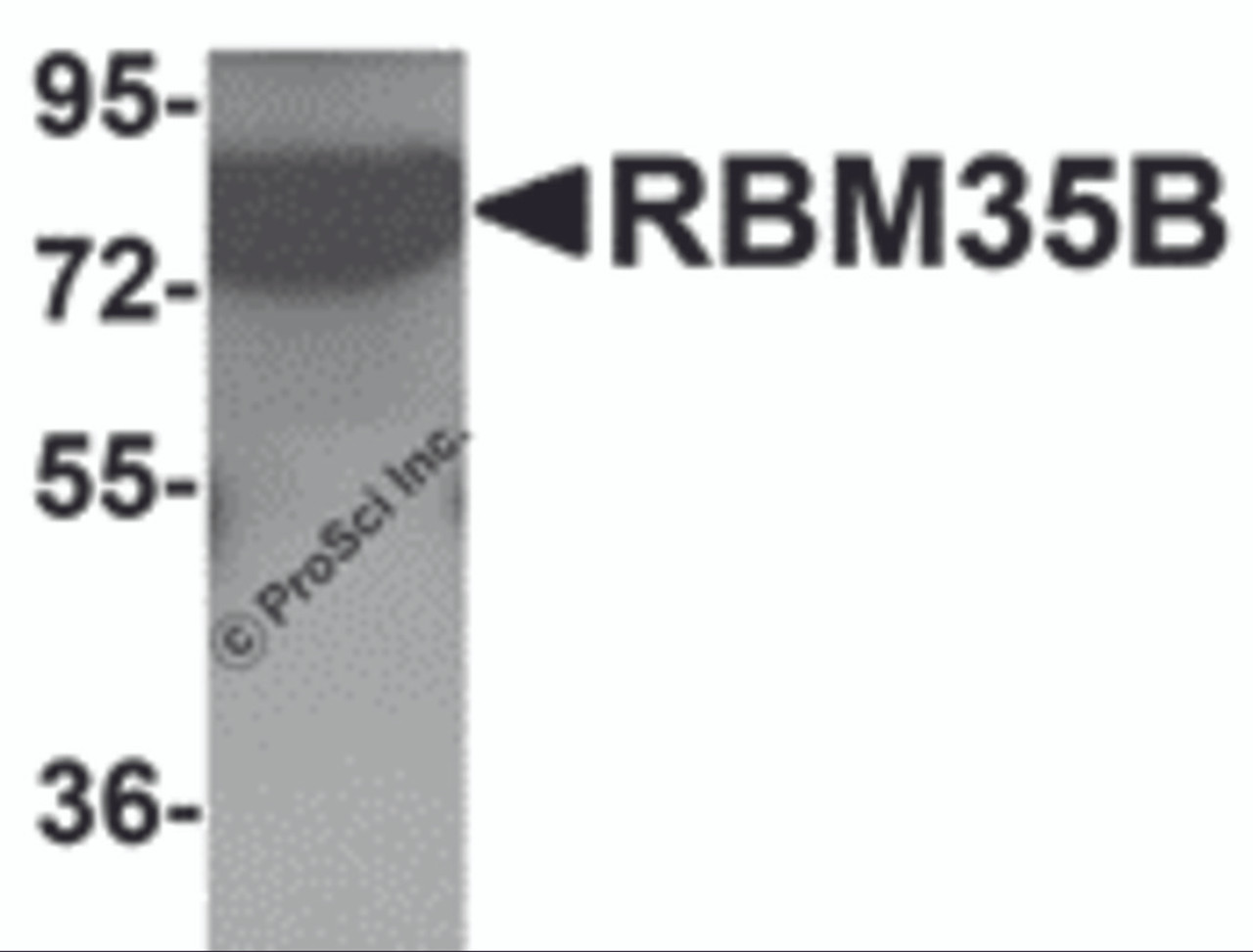 Western blot analysis of RBM35B in human lung tissue lysate with RBM35B antibody at 1 &#956;g/mL.