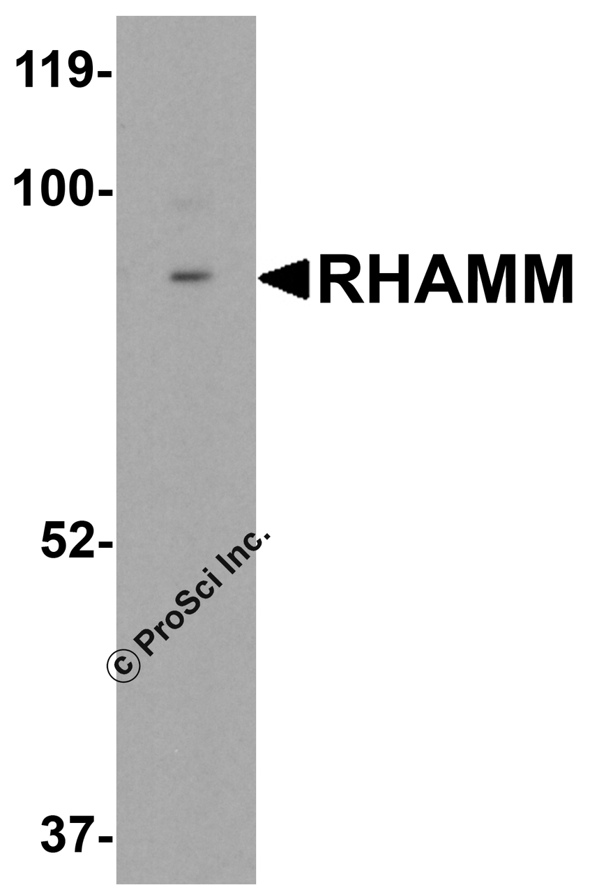 Western blot analysis of RHAMM in rat stomach tissue lysate with RHAMM antibody at 0.5 &#956;g/mL.