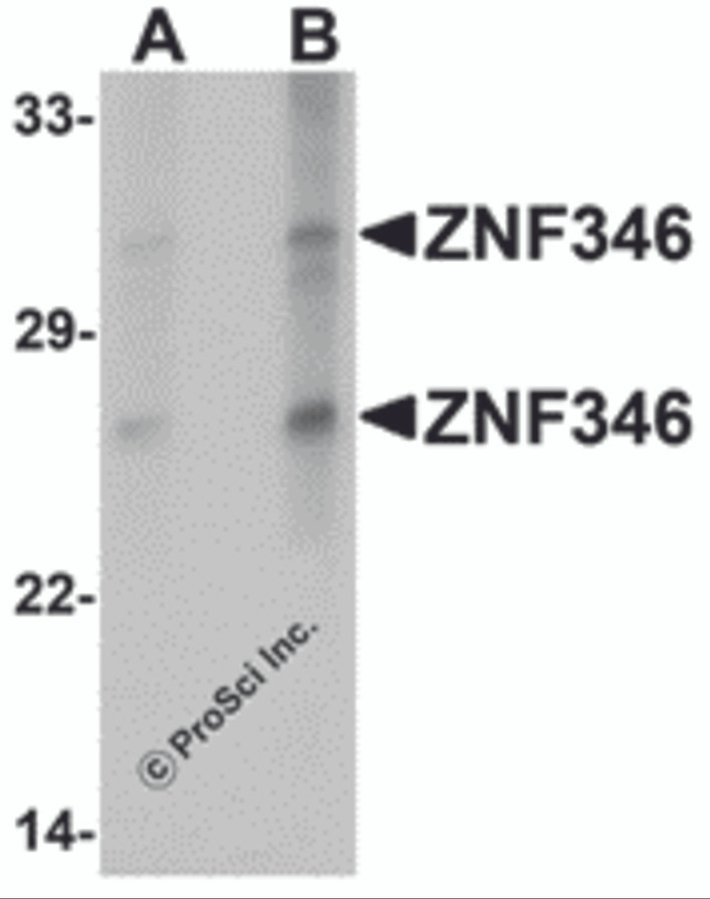 Western blot analysis of ZNF346 in human kidney tissue lysate with ZNF346 antibody at (A) 1 and (B) 2 &#956;g/mL.