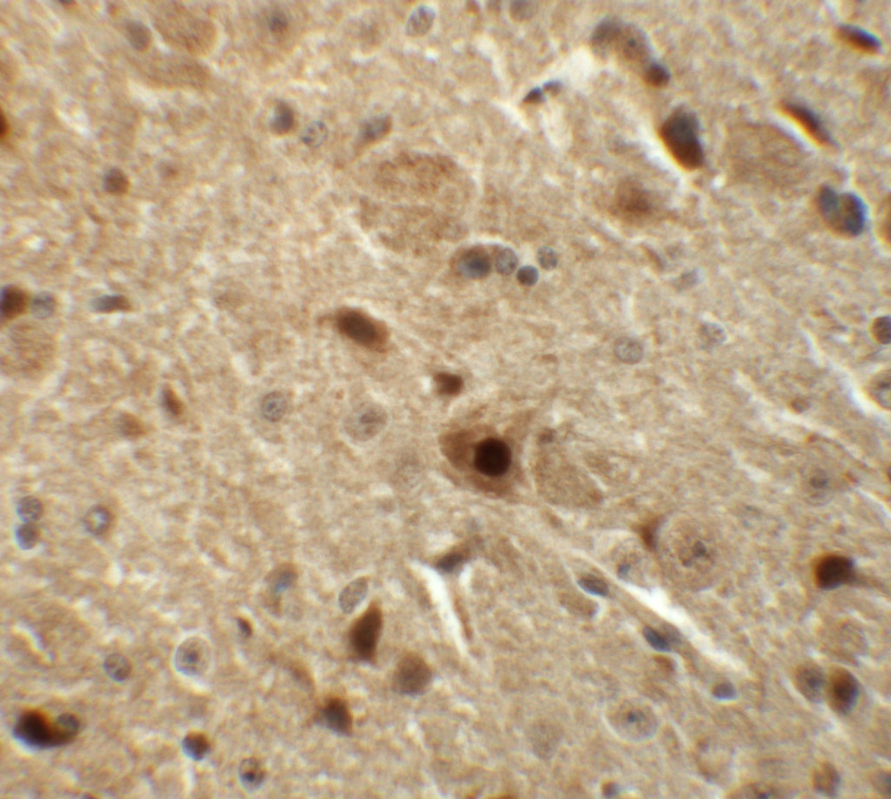 Immunohistochemistry of BAPX1 in mouse brain tissue with BAPX1 antibody at 5 ug/mL.