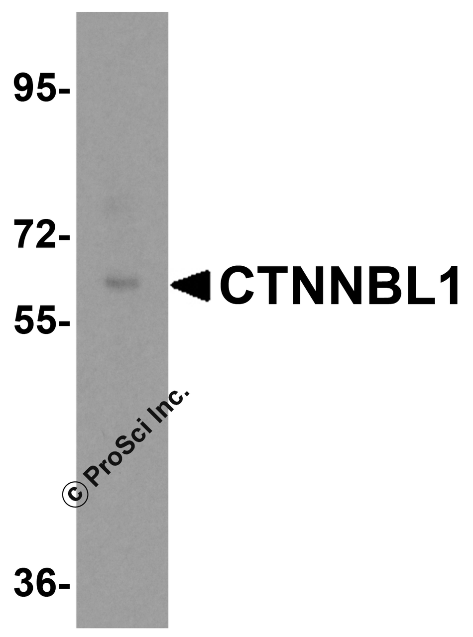 Western blot analysis of CTNNBL1 in human brain tissue lysate with CTNNBL1 antibody at 0.5 &#956;g/mL.