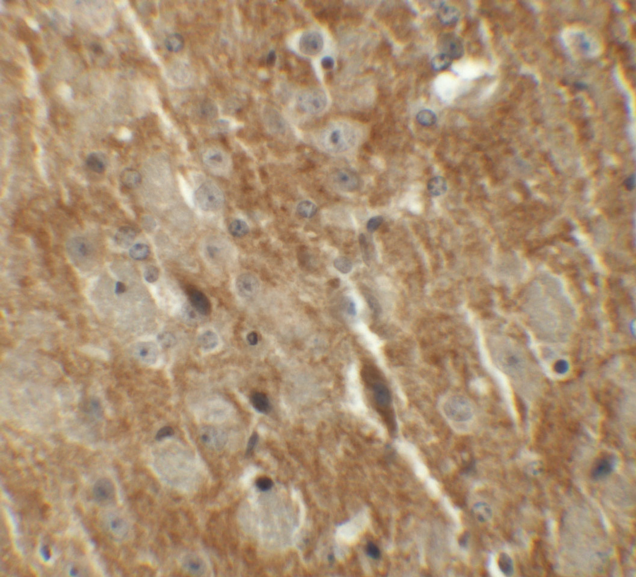 Immunohistochemistry of CTNNBL1 in mouse brain tissue with CTNNBL1 antibody at 5 ug/mL.