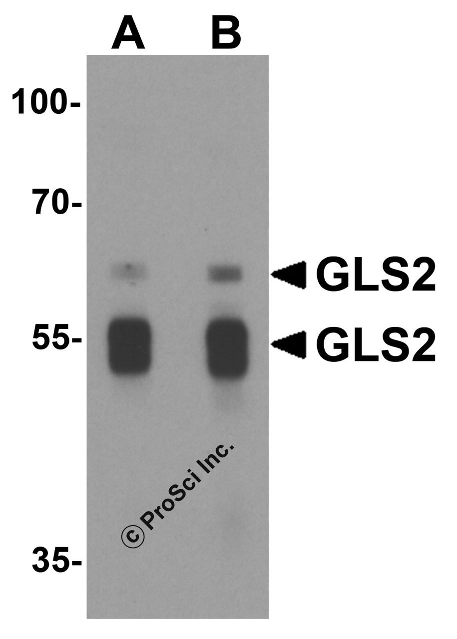 Western blot analysis of GLS2 in rat liver tissue lysate with GLS2 antibody at (A) 1 and (B) 2 &#956;g/mL.
