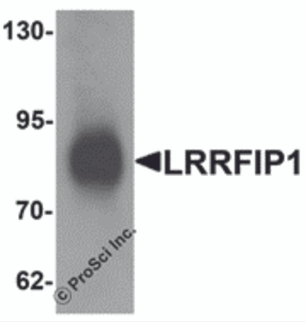 Western blot analysis of LRRFIP1 in human colon tissue lysate with LRRFIP1 antibody at 1 &#956;g/mL.