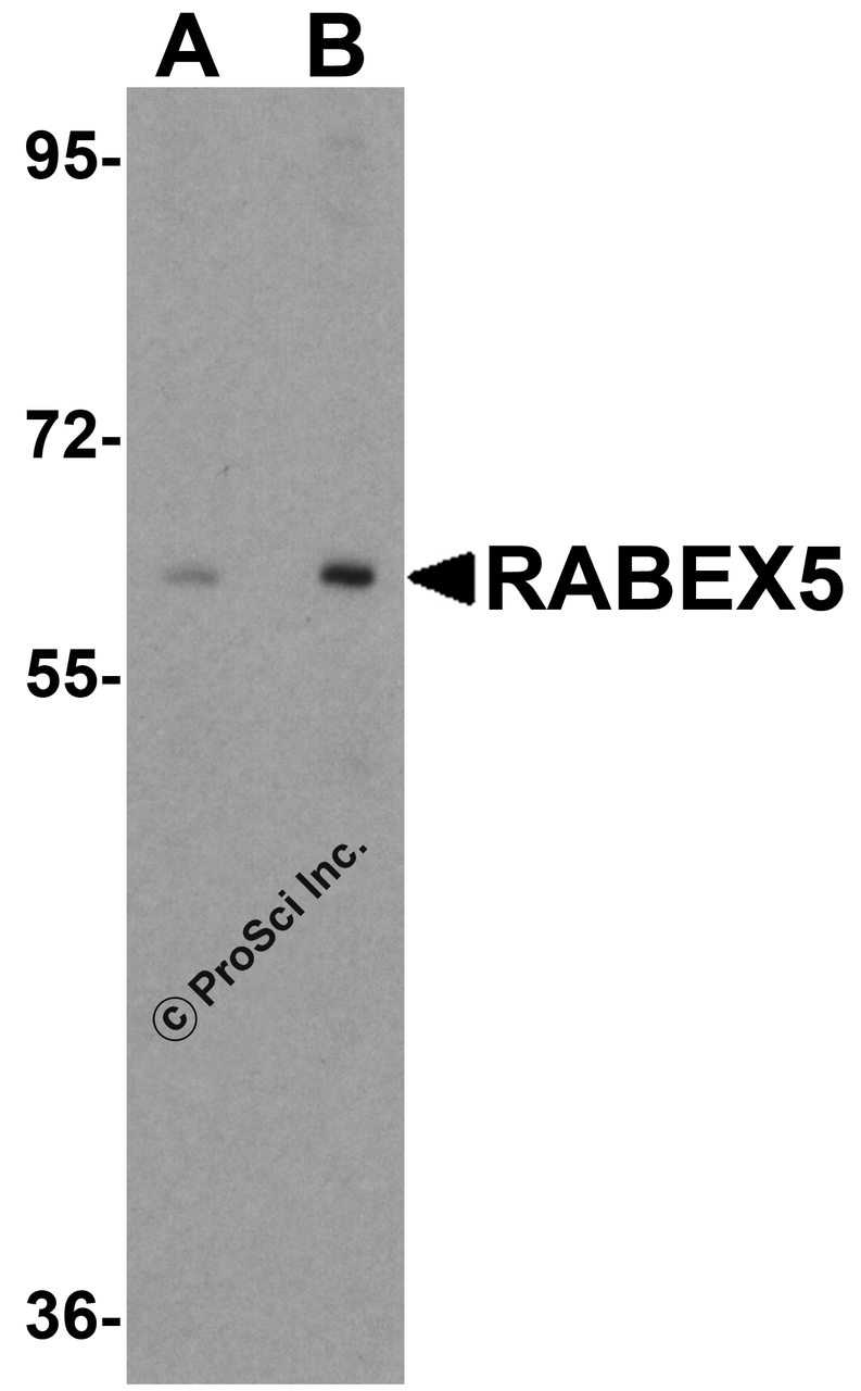 Western blot analysis of RABEX5 in human liver tissue lysate with RABEX5 antibody at (A) 1 and (B) 2 &#956;g/mL.