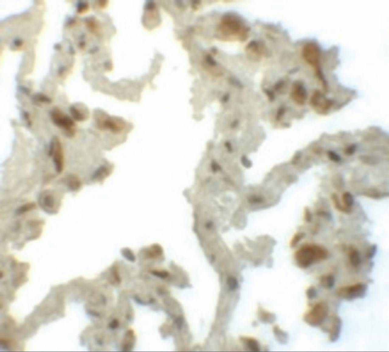 Immunohistochemistry of TM4SF1 in human lung tissue with TM4SF1 antibody at 5 ug/mL.