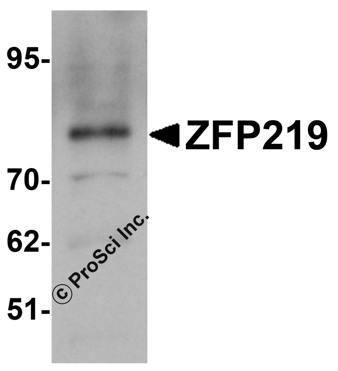 Western blot analysis of ZFP219 in EL4 cell lysate with ZFP219 antibody at 1 &#956;g/mL.