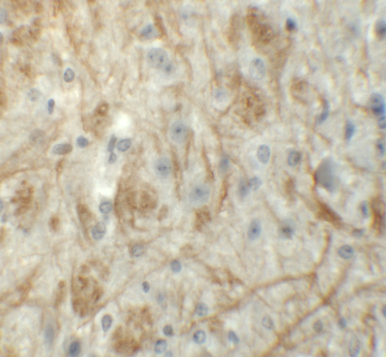 Immunohistochemistry of ZFP219 in mouse brain tissue with ZFP219 antibody at 5 ug/mL.