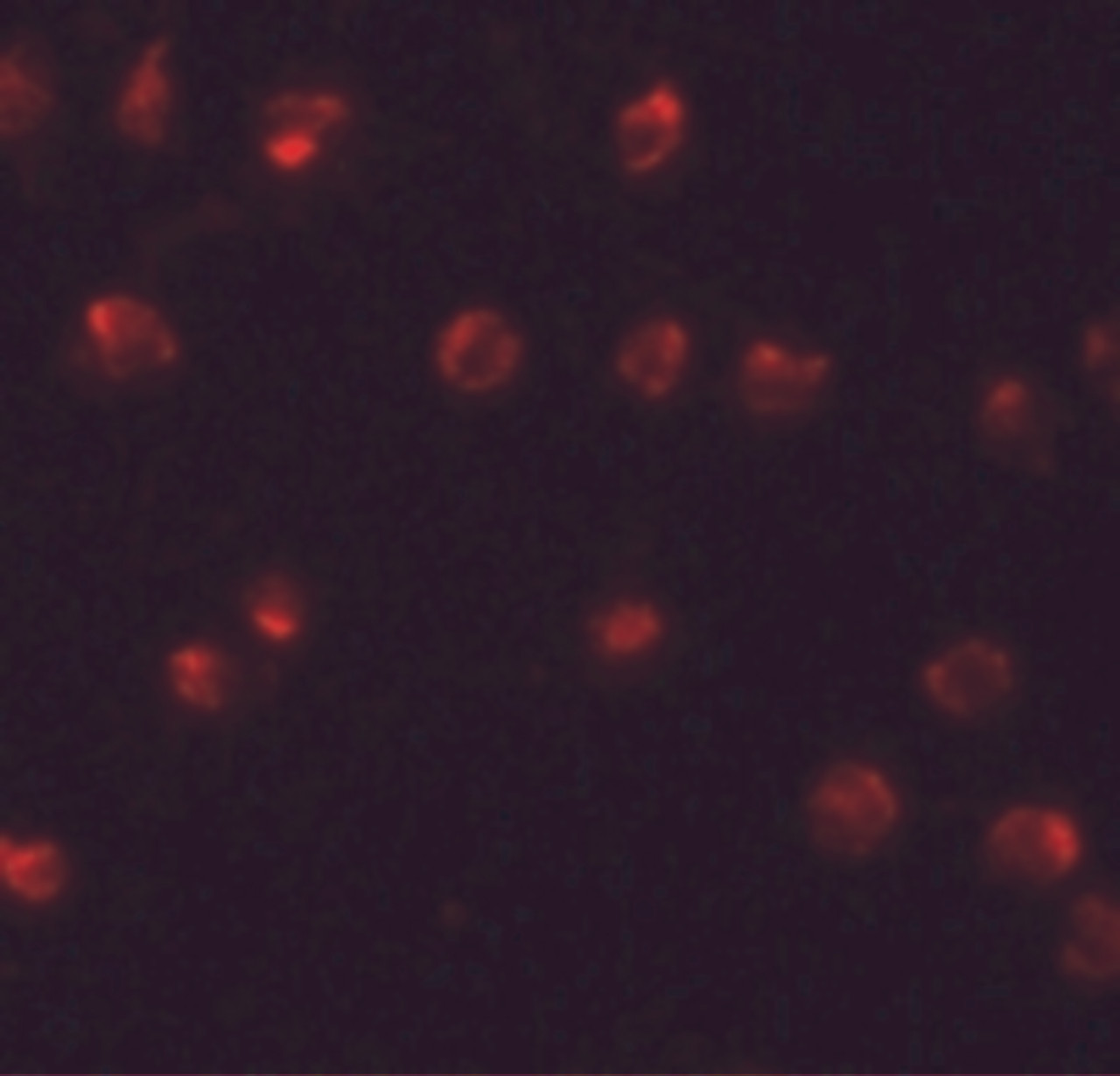 Immunofluorescence of ZFP291 in A20 cells with ZFP291 antibody at 20 ug/mL.