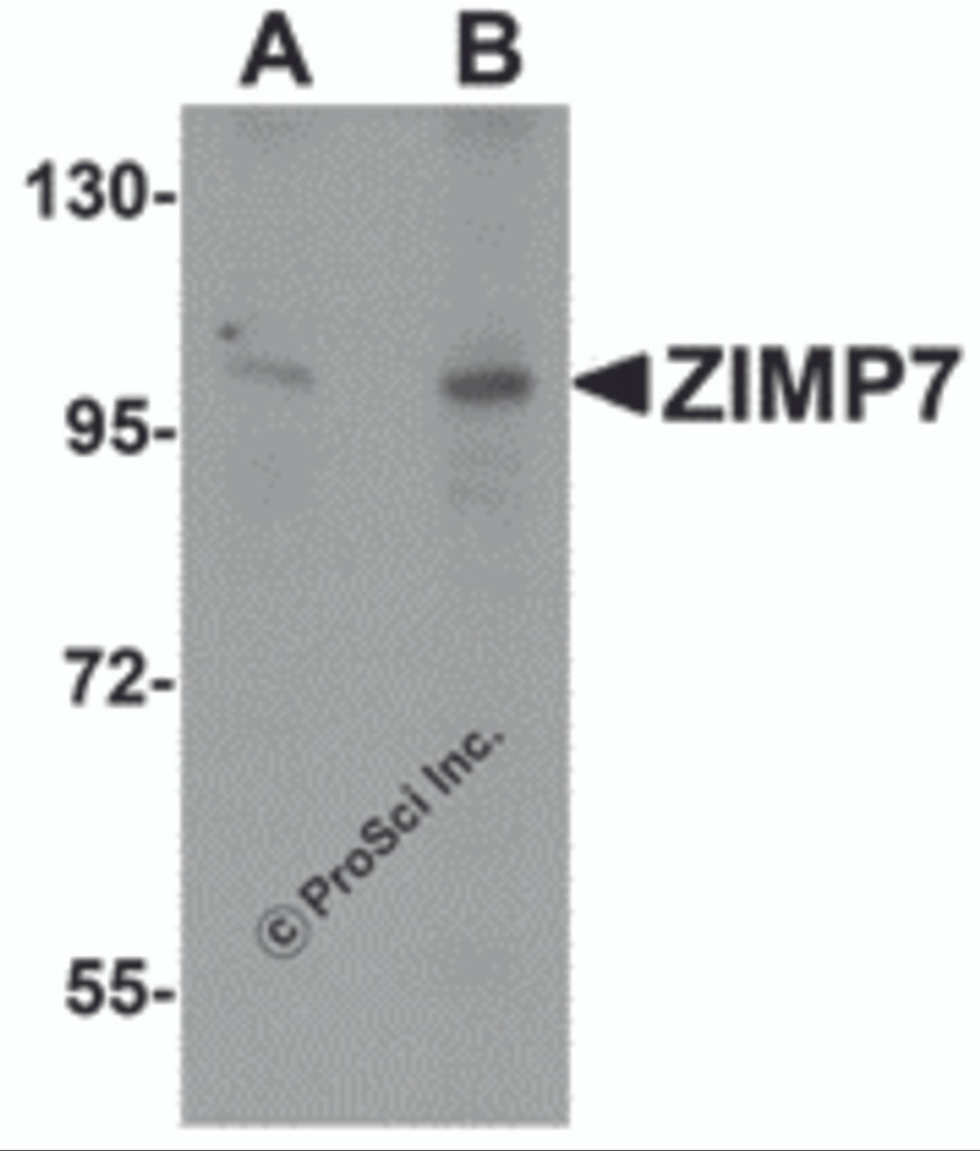 Western blot analysis of ZIMP7 in A20 cell lysate with ZIMP7 antibody at (A) 0.25 &#956;g/ml and (B) 0.5 &#956;g/mL.