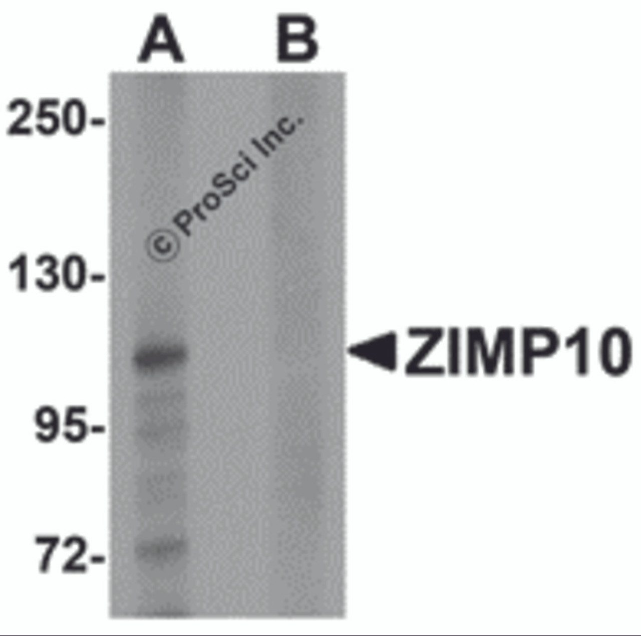 Western blot analysis of ZIMP10 in K562 cell lysate with ZIMP10 antibody at 0.5 &#956;g/mL in (A) the absence and (B) the presence of blocking peptide