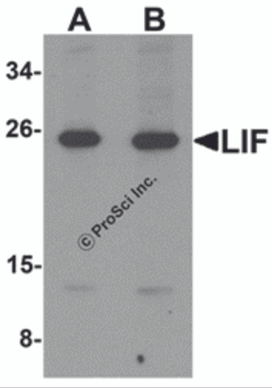 Figure 1 Western Blot Validation in Mouse 3T3 Cell Lysate
Loading: 15 &#956;g of lysates per lane.
Antibodies: LIF 6245, (A: 1 &#956;g/mL, B: 2 &#956;g/mL) , 1h incubation at RT in 5% NFDM/TBST.
Secondary: Goat anti-rabbit IgG HRP conjugate at 1:10000 dilution.