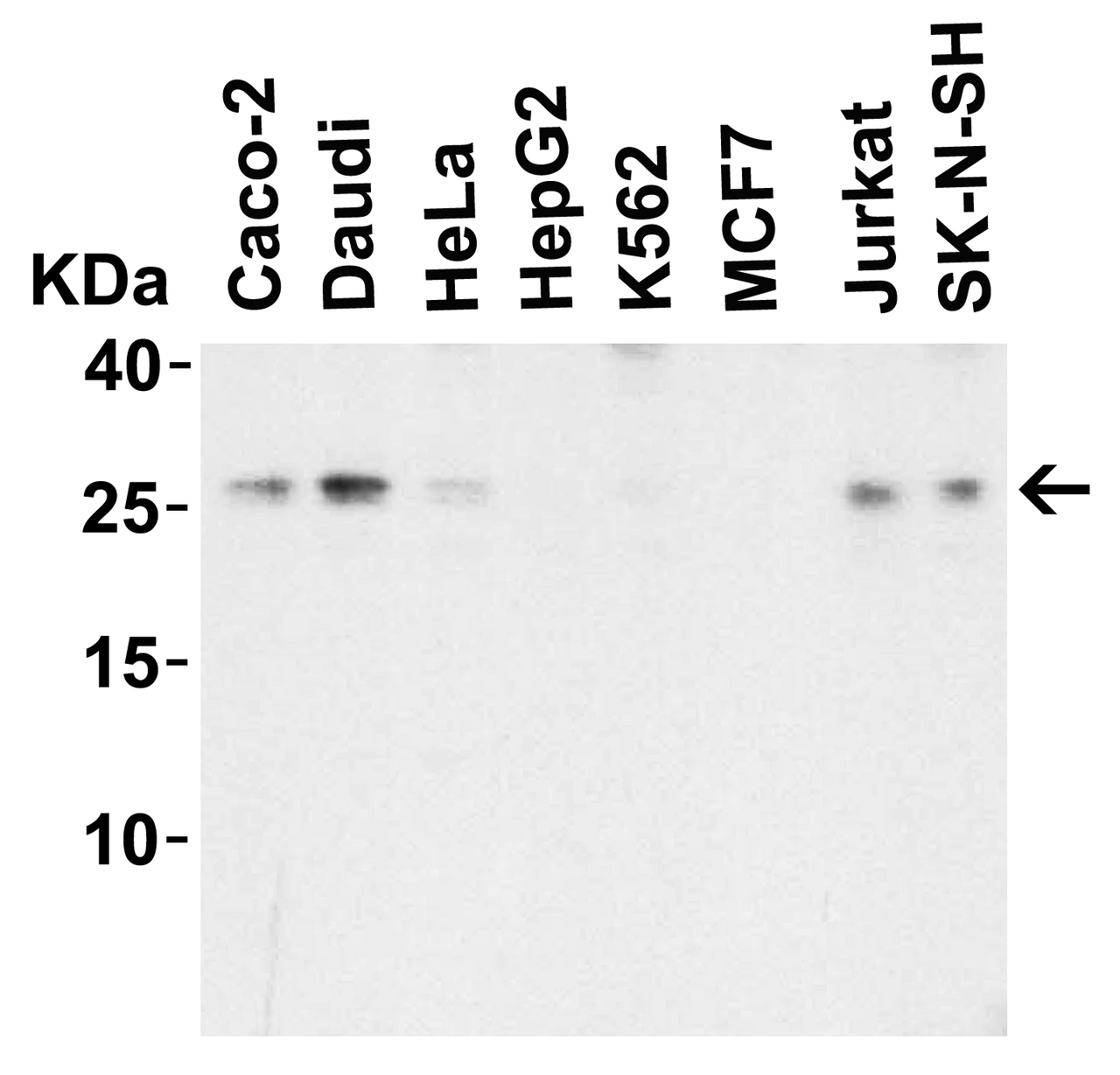 Figure 2 Western Blot Validation in Human Cell Lines
Loading: 15 ug of lysates per lane.
Antibodies: LIF 6245, (1 ug/mL) , 1h incubation at RT in 5% NFDM/TBST.
Secondary: Goat anti-rabbit IgG HRP conjugate at 1:10000 dilution.