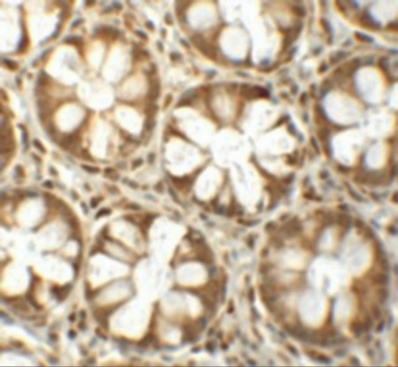 Immunohistochemistry of SLAMF1 in human colon tissue with SLAMF1 antibody at 5 ug/mL.