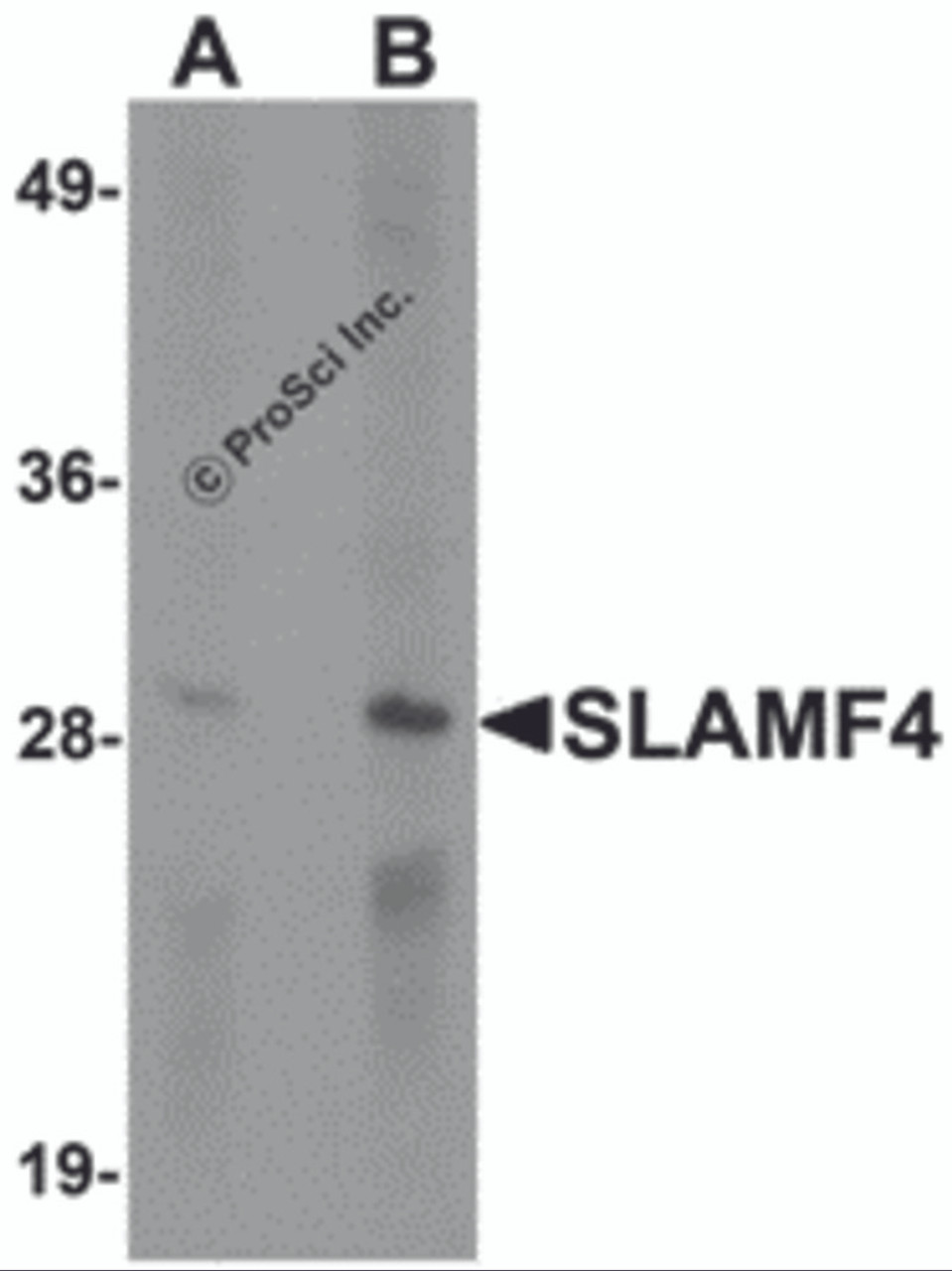 Western blot analysis of SLAMF4 in Daudi cell lysate with SLAMF4 antibody at (A) 1 and (B) 2 &#956;g/mL.