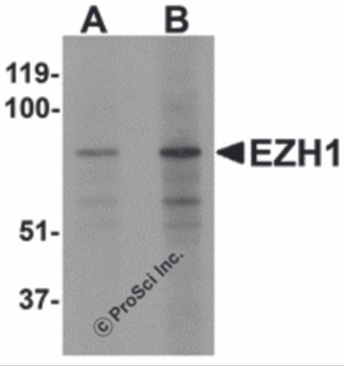 Western blot analysis of EZH1 in mouse lung tissue lysate with EZH1 antibody at (A) 1 and (B) 2 &#956;g/mL