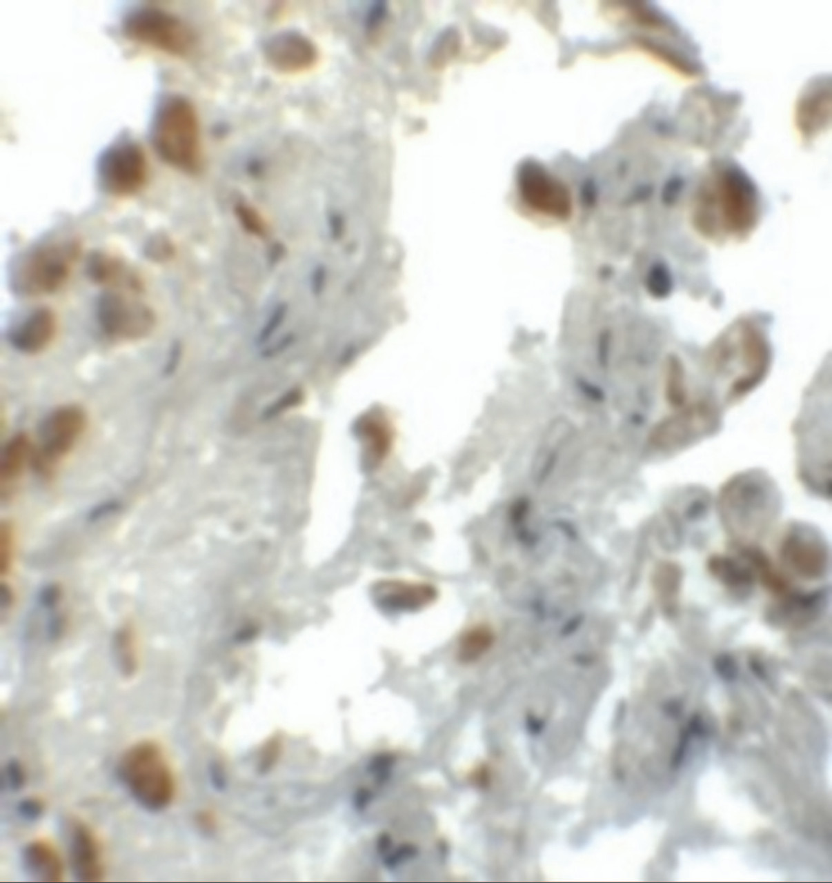 Immunohistochemistry of EZH1 in human lung tissue with EZH1 antibody at 5 ug/mL.