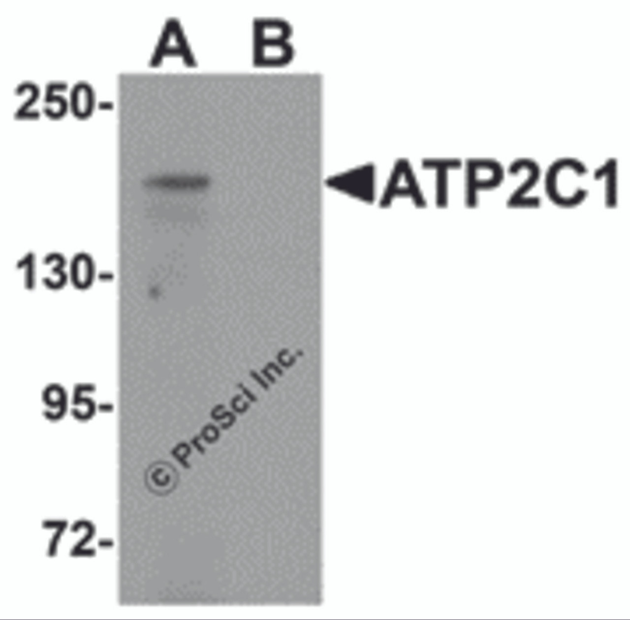 Western blot analysis of ATP2C1 in mouse brain tissue lysate with ATP2C1 antibody at 1 &#956;g/mL in (A) the absence and (B) the presence of blocking peptide.