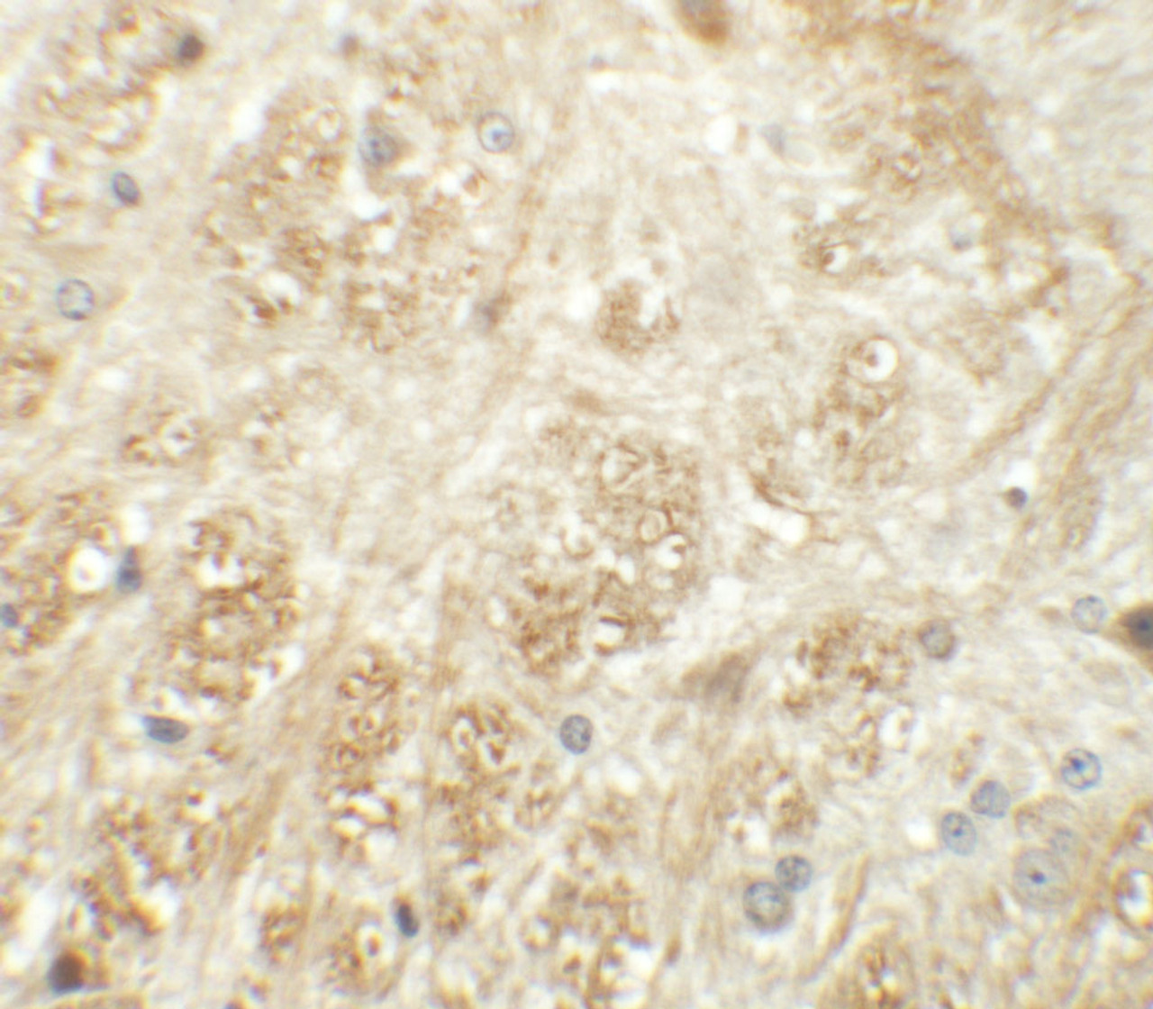 Immunohistochemistry of ATP2C1 in mouse brain tissue with ATP2C1 antibody at 5 ug/mL.