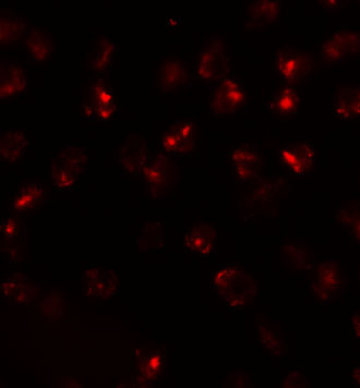 Immunofluorescence of ATP2C2 in 3T3 cells with ATP2C2 antibody at 20 ug/mL.