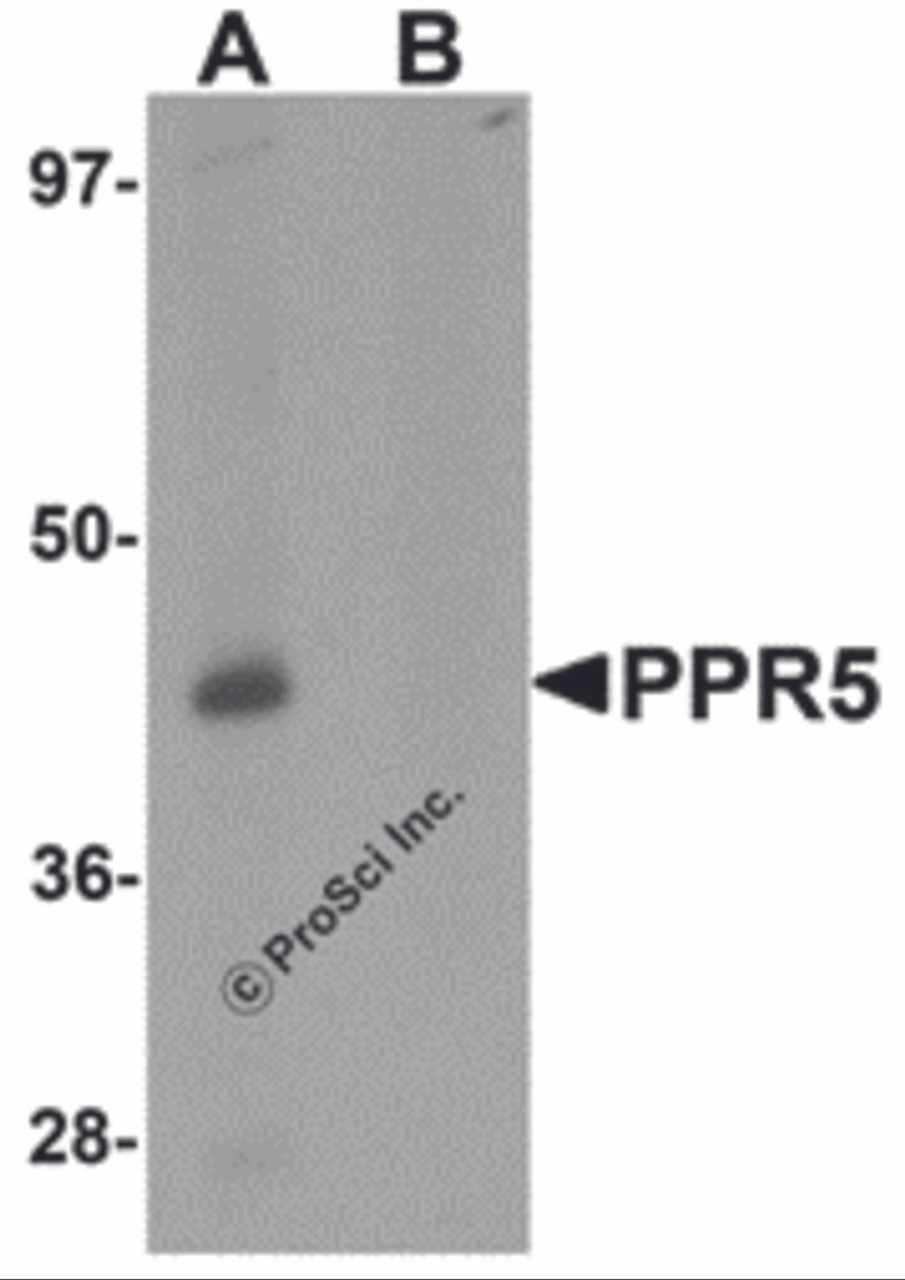 Western blot analysis of PRR5 in SK-N-SH cell lysate with PRR5 antibody at 1 &#956;g/mL in (A) the absence and (B) the presence of blocking peptide