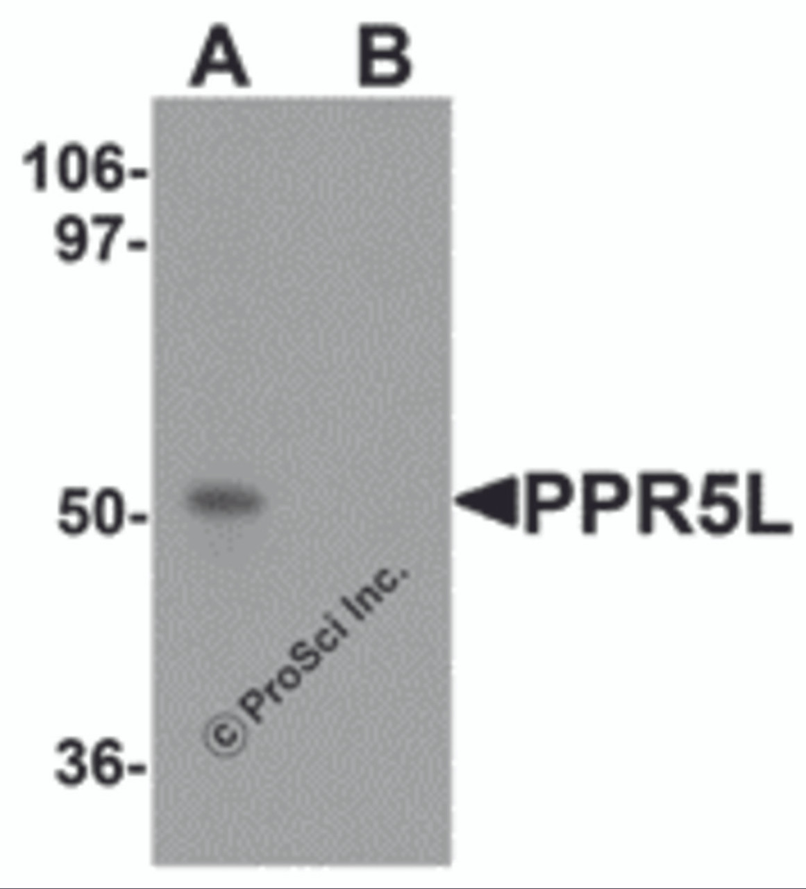 Western blot analysis of PRR5L in 3T3 cell lysate with PRR5L antibody at 1 &#956;g/mL in (A) the absence and (B) the presence of blocking peptide