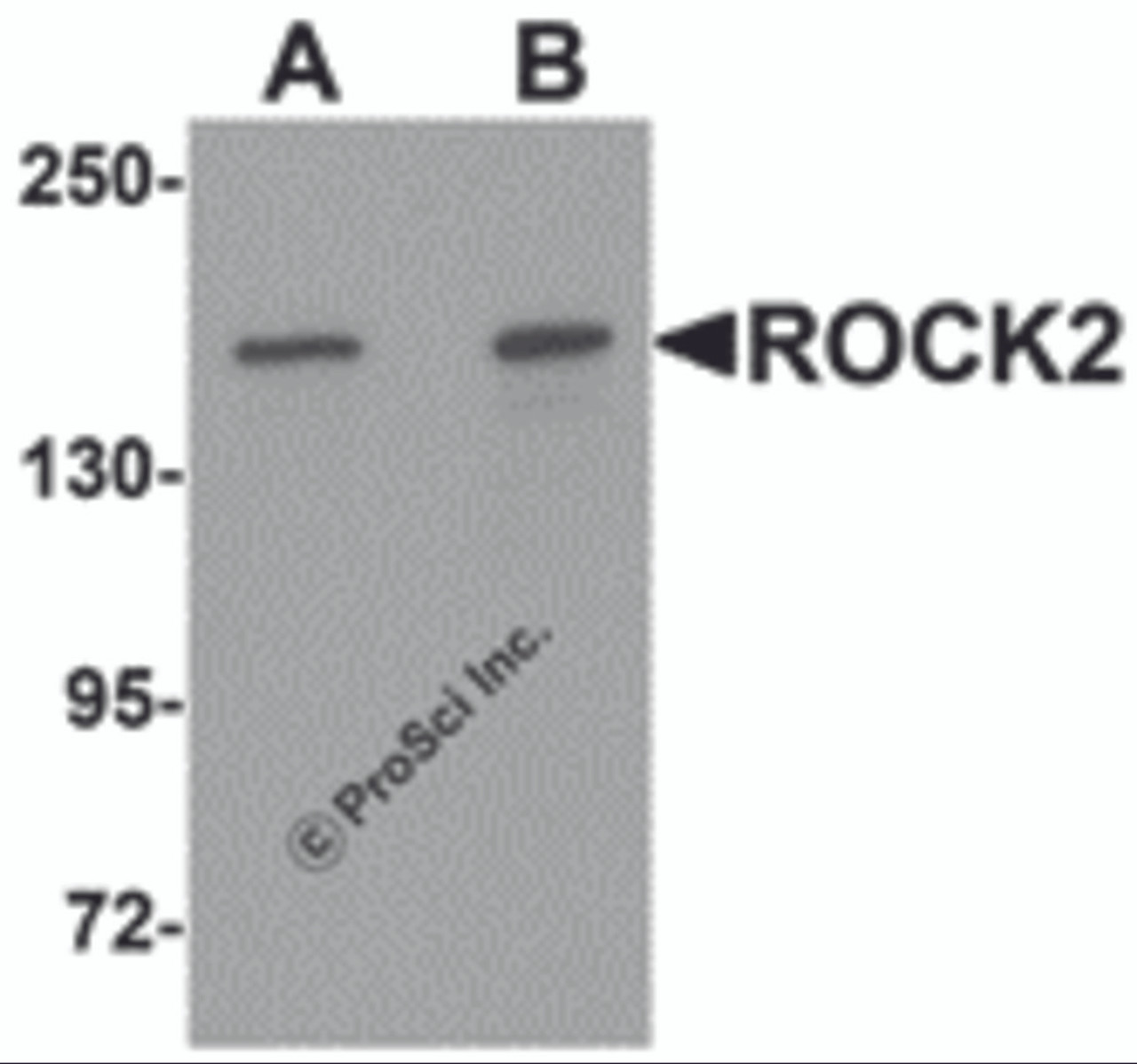 Western blot analysis of ROCK2 in mouse brain tissue lysate with ROCK2 antibody at (A) 1 and (B) 2 &#956;g/mL