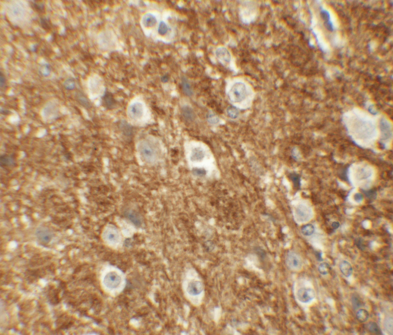 Immunohistochemistry of ROCK2 in mouse brain tissue with ROCK2 antibody at 5 ug/mL.